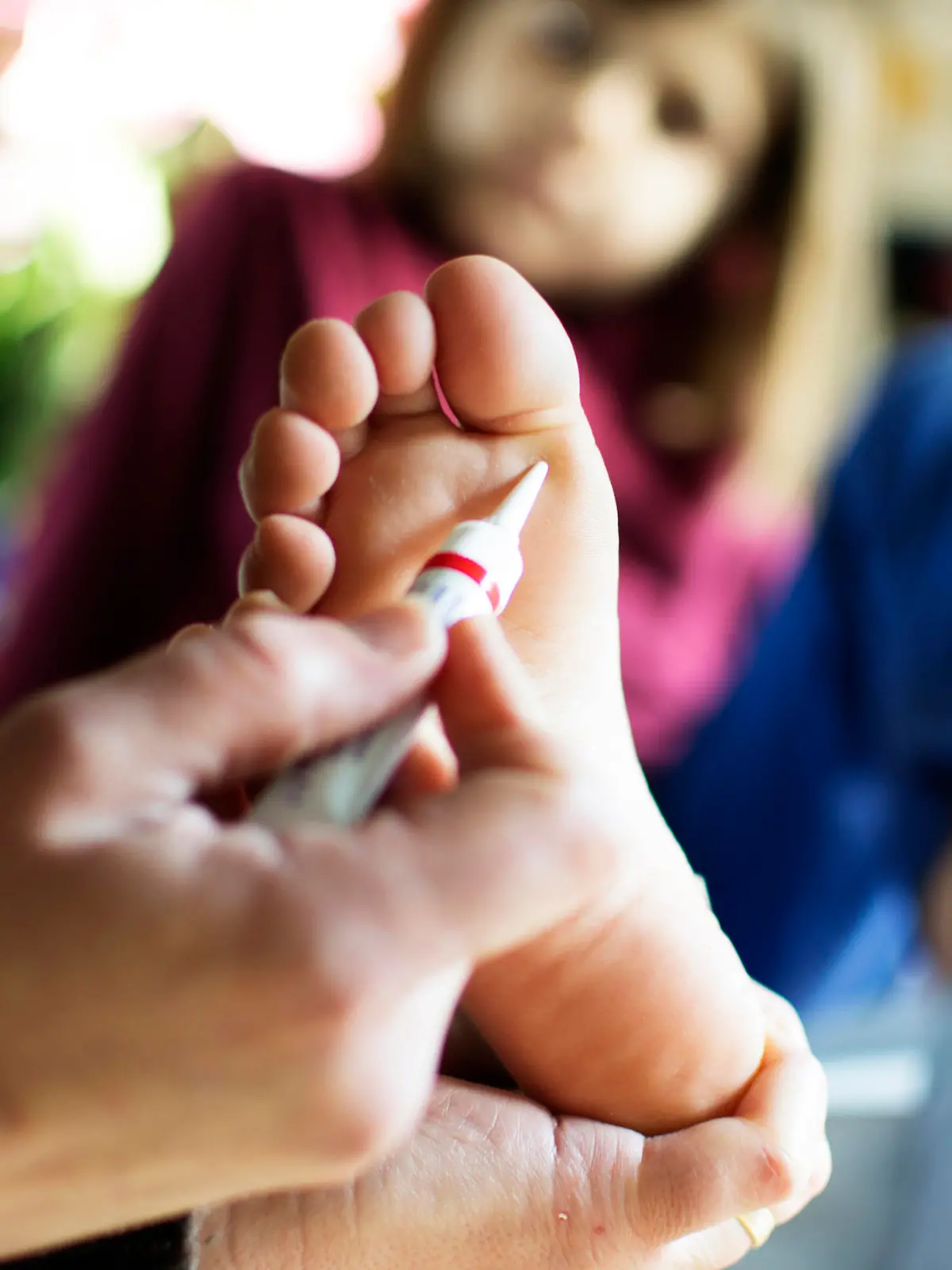 A parent applying verruca medicine to a child's foot