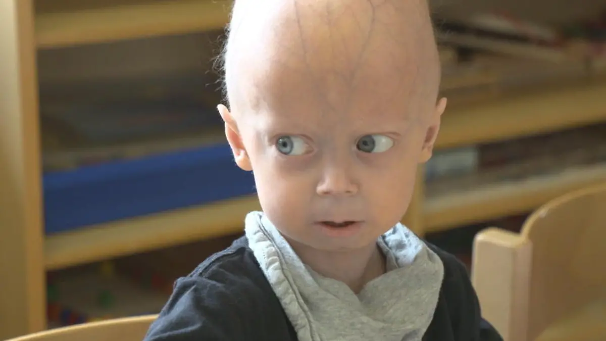 Er soll ein langes und glückliches Leben haben Jetzt darf Luke (3) sogar in die Kita