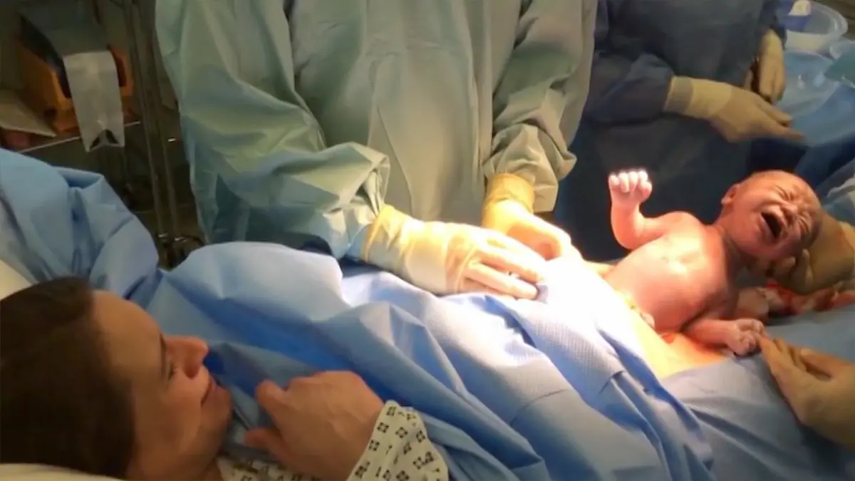 Diese Kaiserschnitt-Geburt ist etwas Besonderes Baby drückt sich fast selbst raus