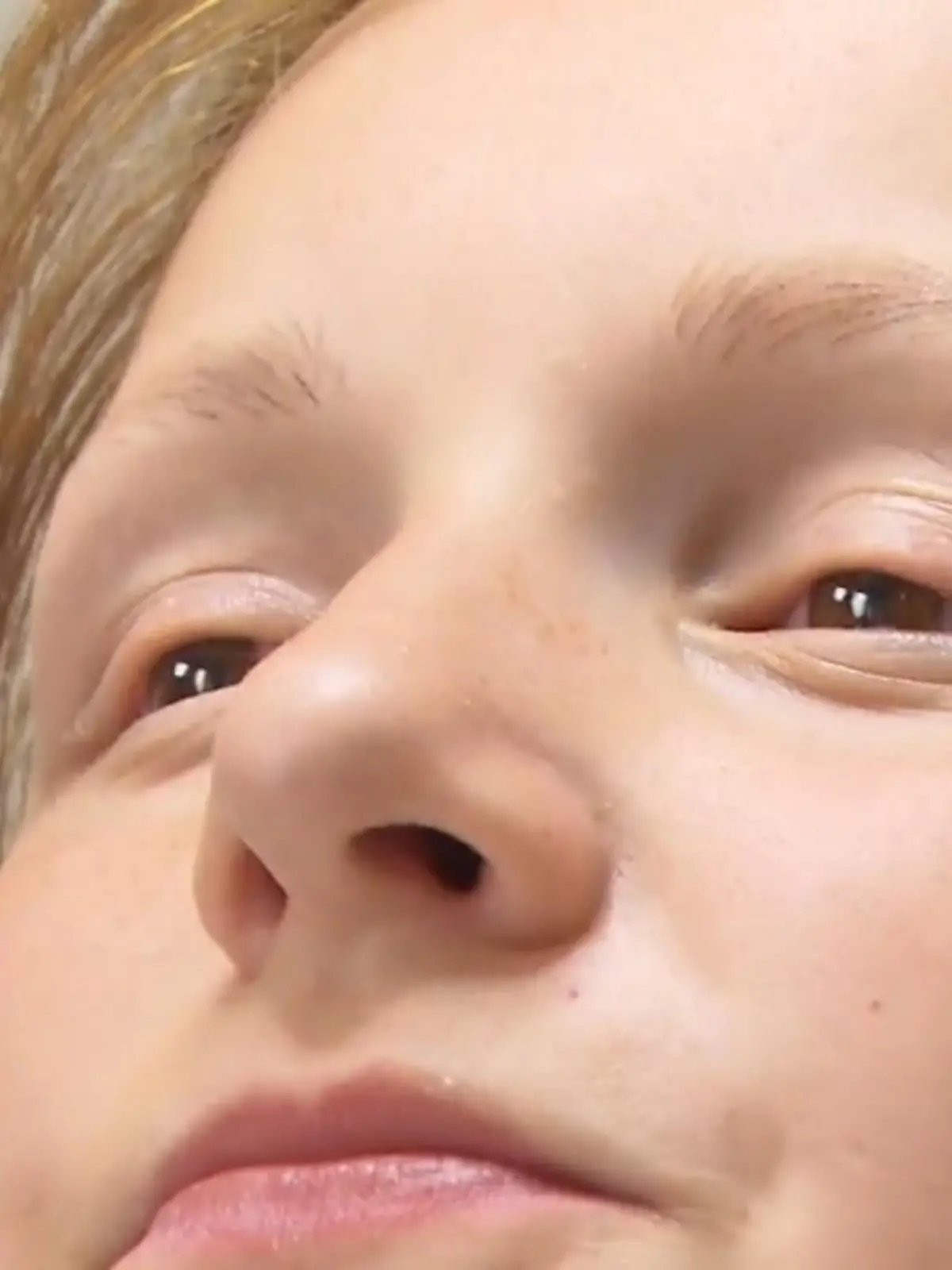Erst fallen einzelne Büschel aus, dann mehr und mehr Haare - schließlich auch Wimpern und Augenbrauen. So war es bei einer 12-Jährigen aus Duisburg. Sie leidet lange Zeit vor allem unter den Kommentaren ihrer Mitschüler. RTL WEST zeigt, was ihr Lächeln zurückgebracht hat.