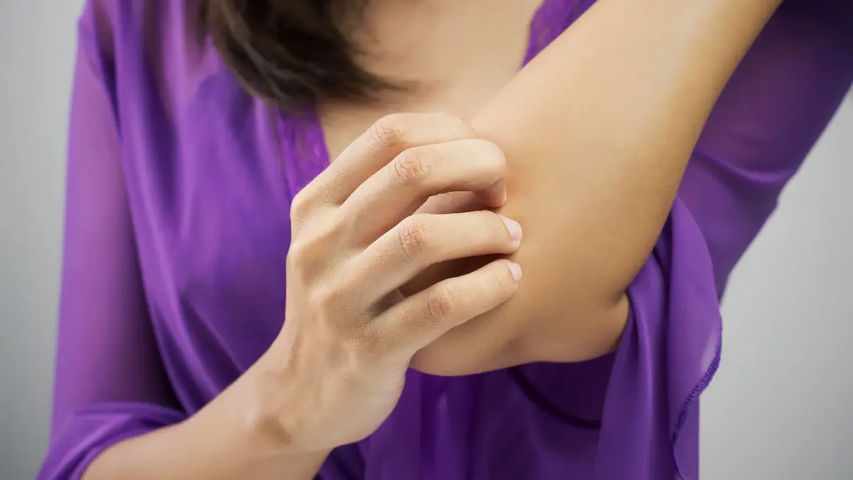 Woman scratching her arm