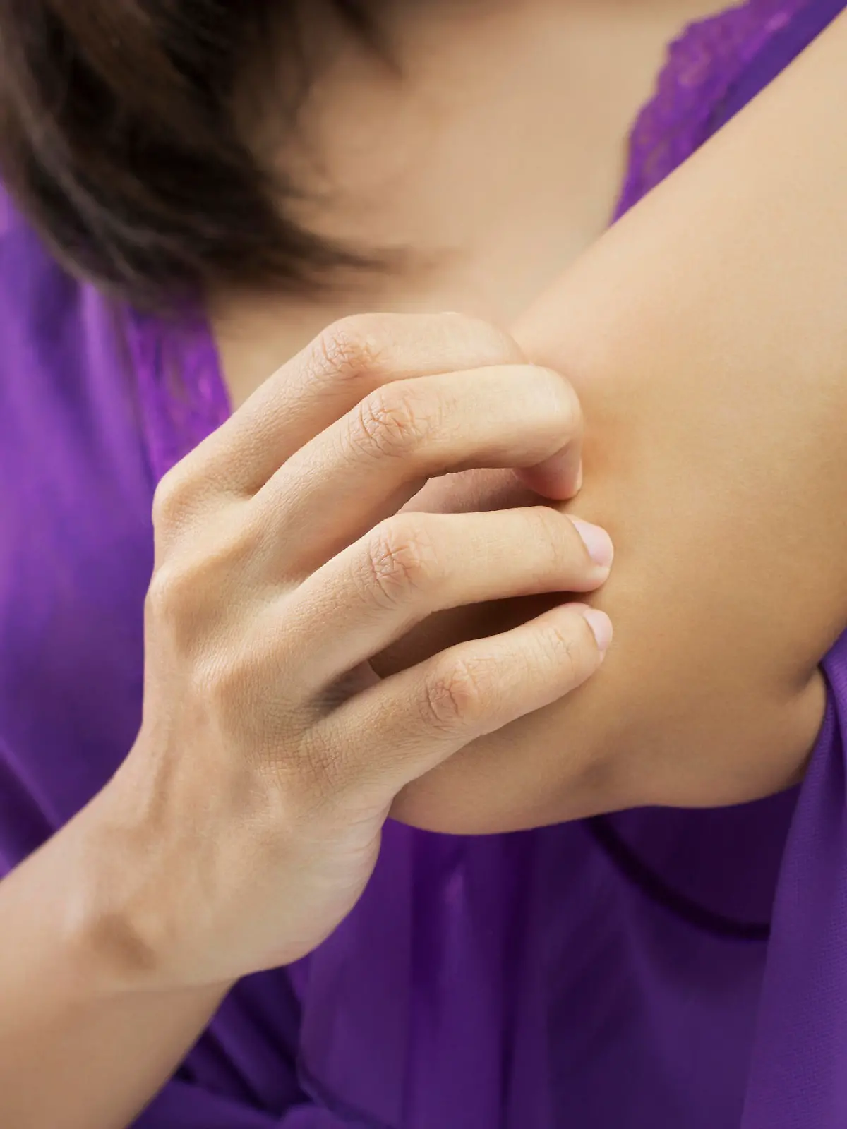 Woman scratching her arm