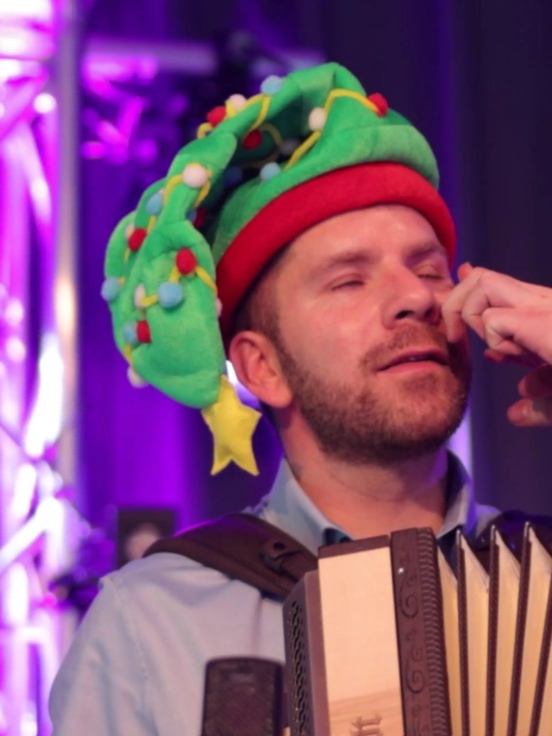 Musikalisch und auch optisch keine Schwäche zeigen: Die Augenringe von Harmonika-Spieler Adrian sollen mit Augenpads verschwinden.