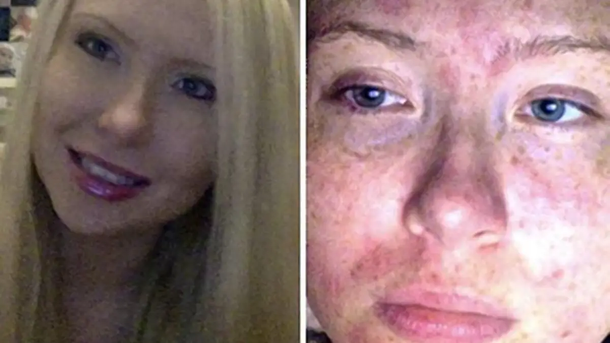 (c) JULIE REID vorher nachher