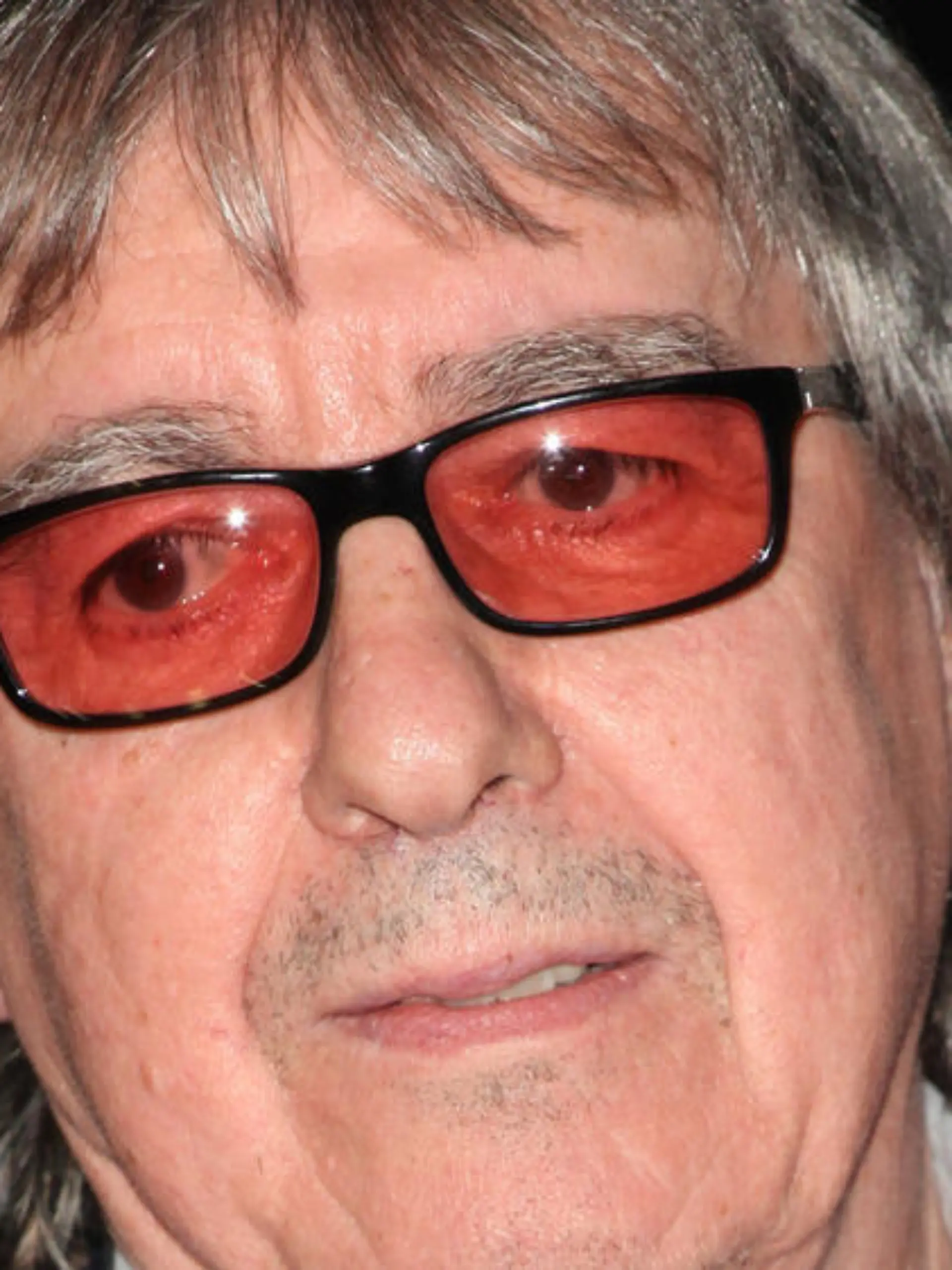 Bill Wyman hat Prostatakrebs