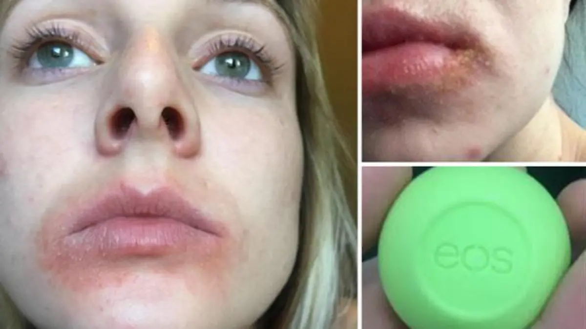 EOS Skandal Augusta Falletta