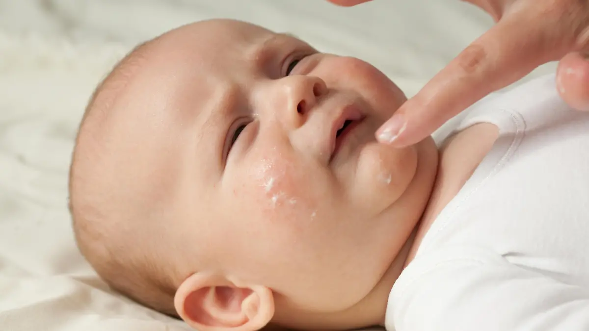 Mutter cremt trockene Stellen beim Baby ein