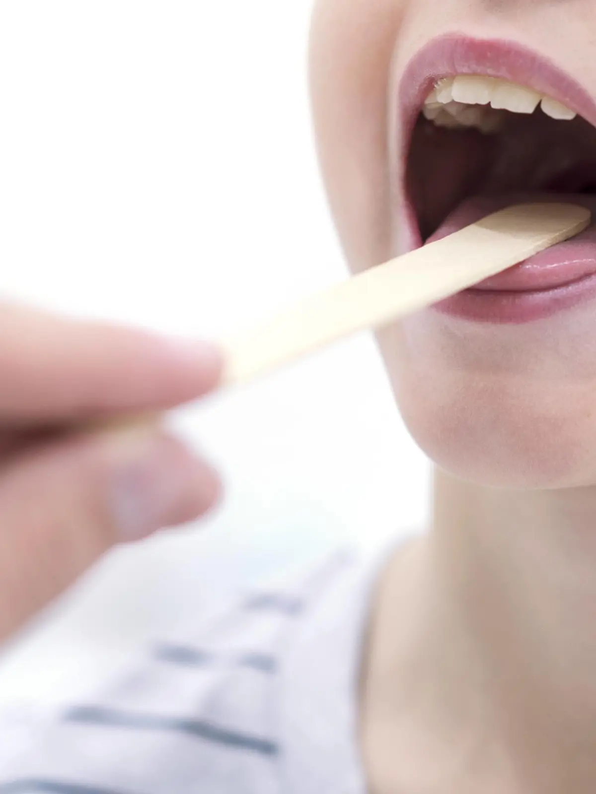 Boy with mouth open and tongue depressor Boy with mouth open and tongue depressor. PUBLICATIONxINxGERxSUIxHUNxONLY SCIENCExPHOTOxLIBRARY F022/9689  