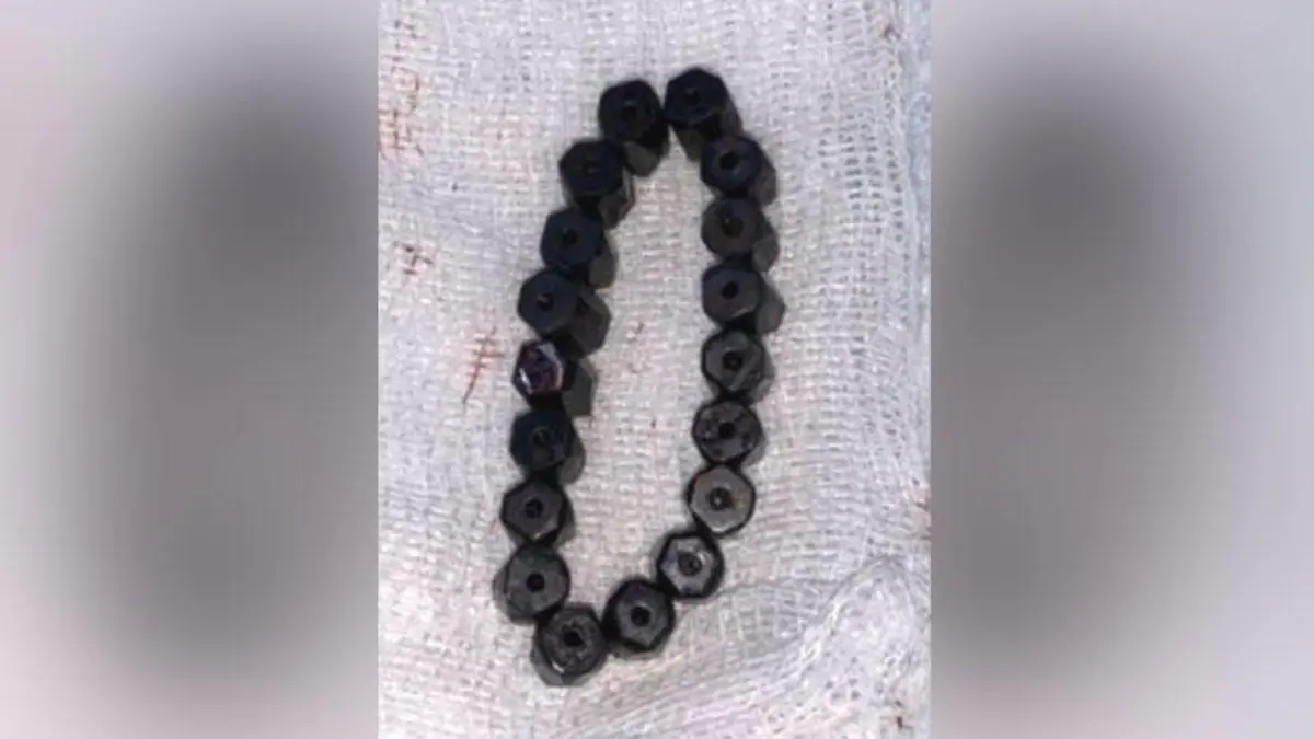 Im Darm fügten die einzelnen Magneten sich dann wieder zusammen und bildeten eine Armband-Form.
