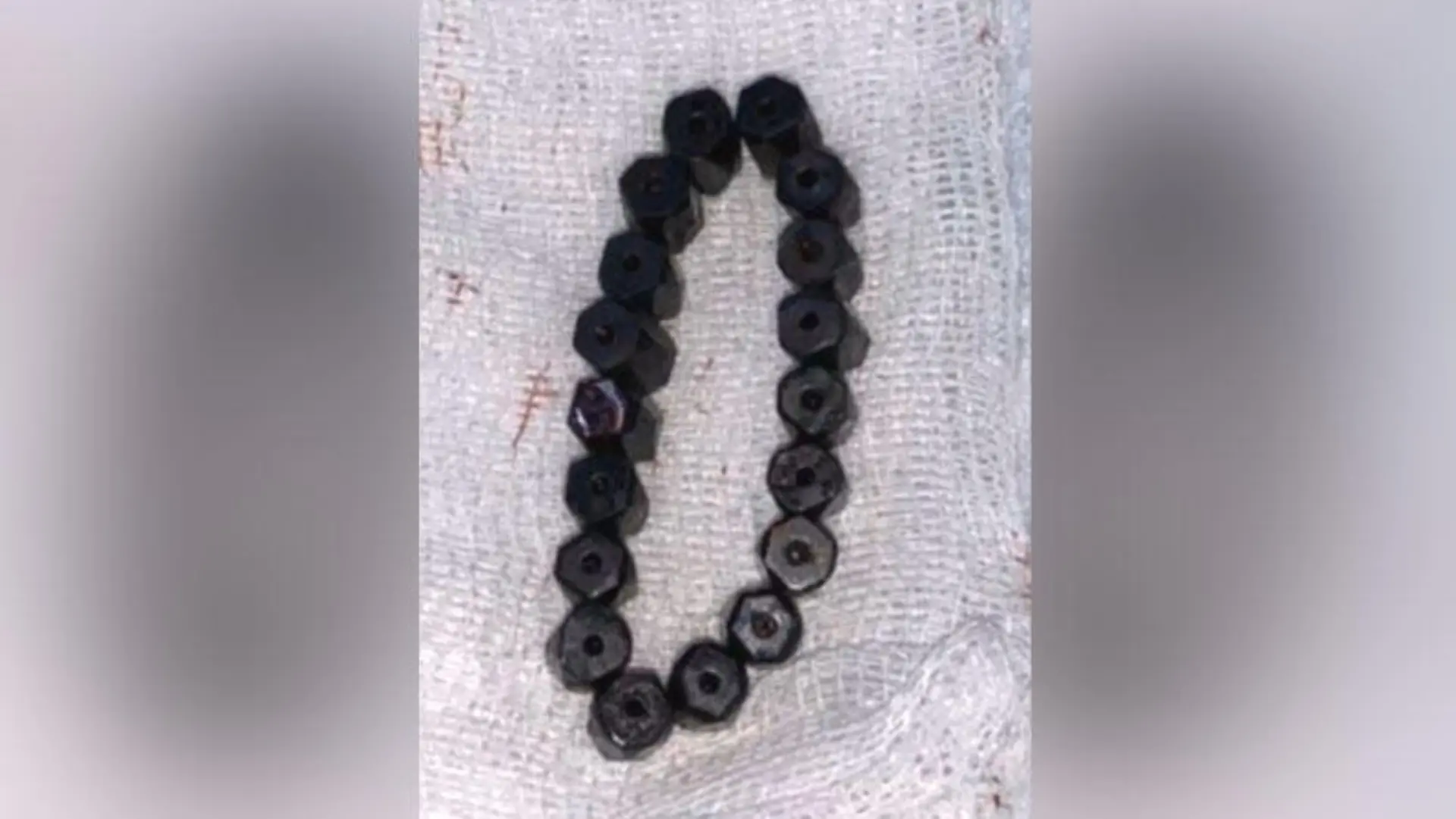 Im Darm fügten die einzelnen Magneten sich dann wieder zusammen und bildeten eine Armband-Form.