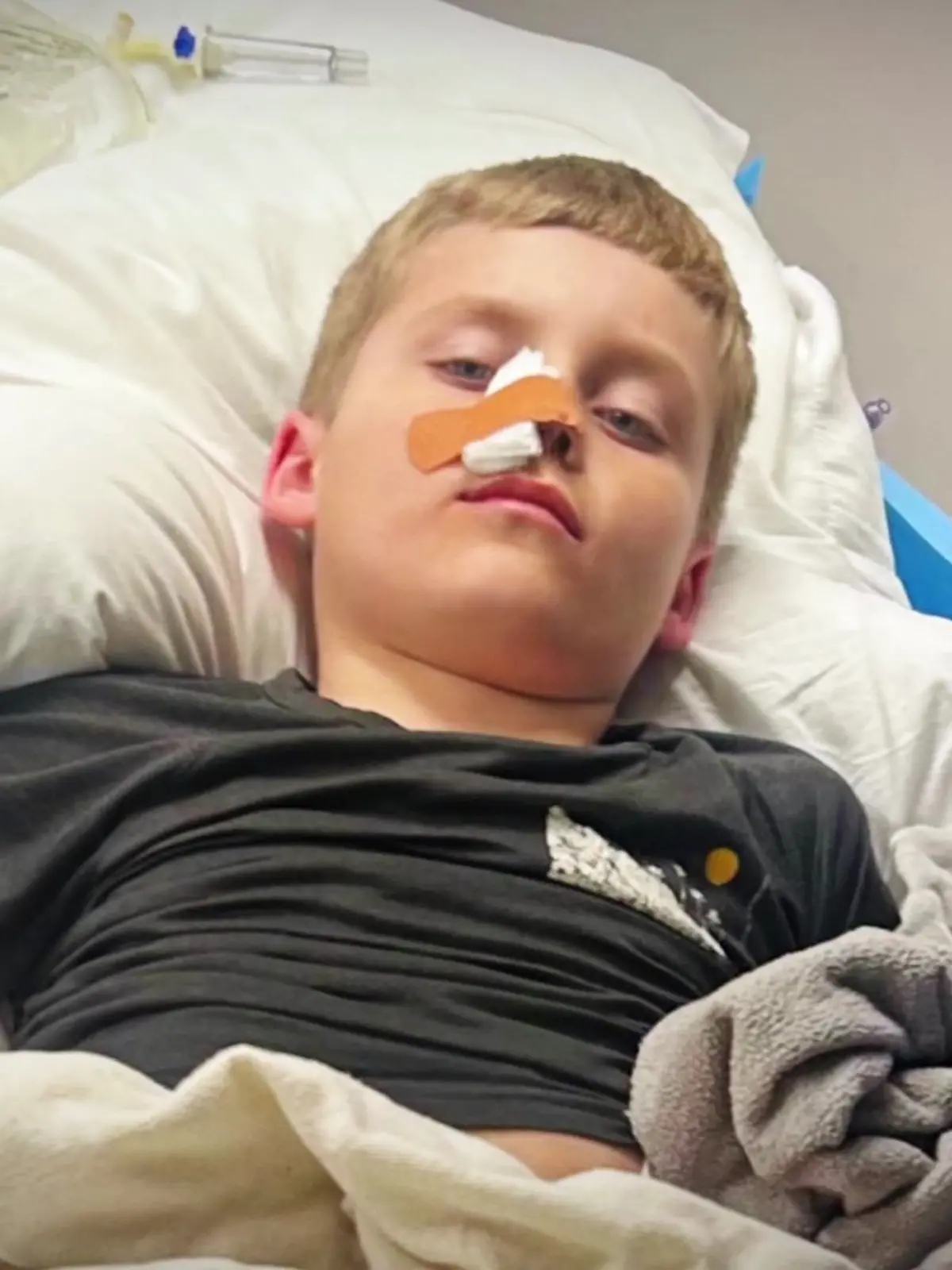 Gus (9) hatte einen Pfeil in seinem Kopf. Doch er überlebt wie durch ein Wunder.