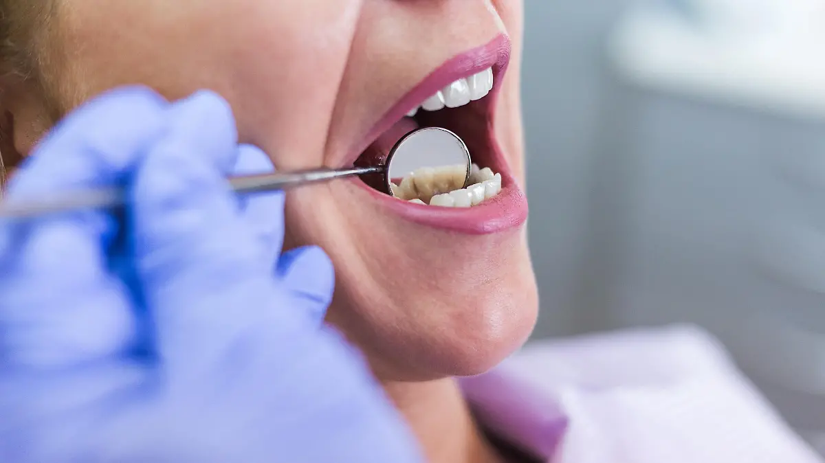 Open female mouth during oral checkup at the dentist. Selective focus