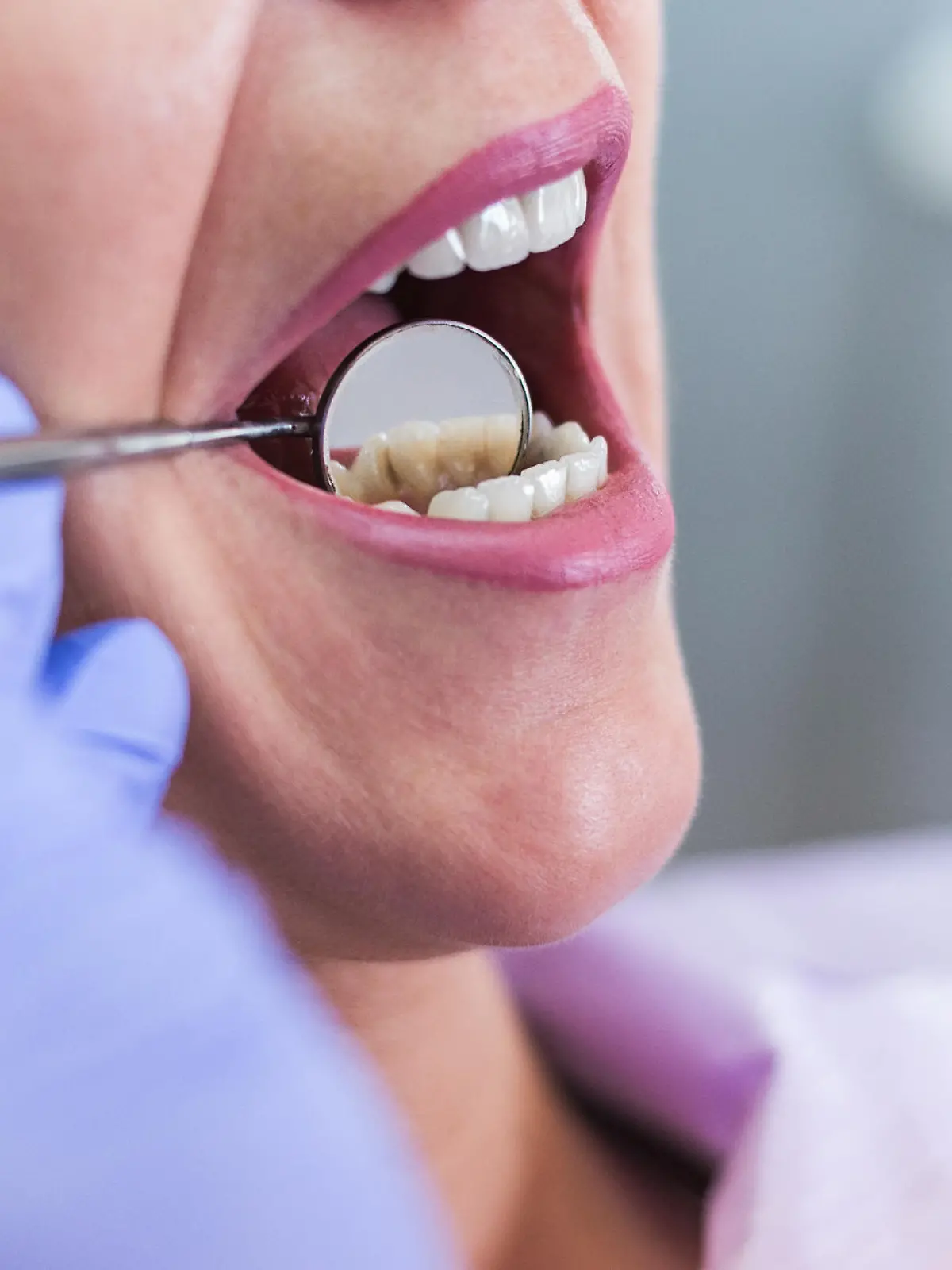Open female mouth during oral checkup at the dentist. Selective focus