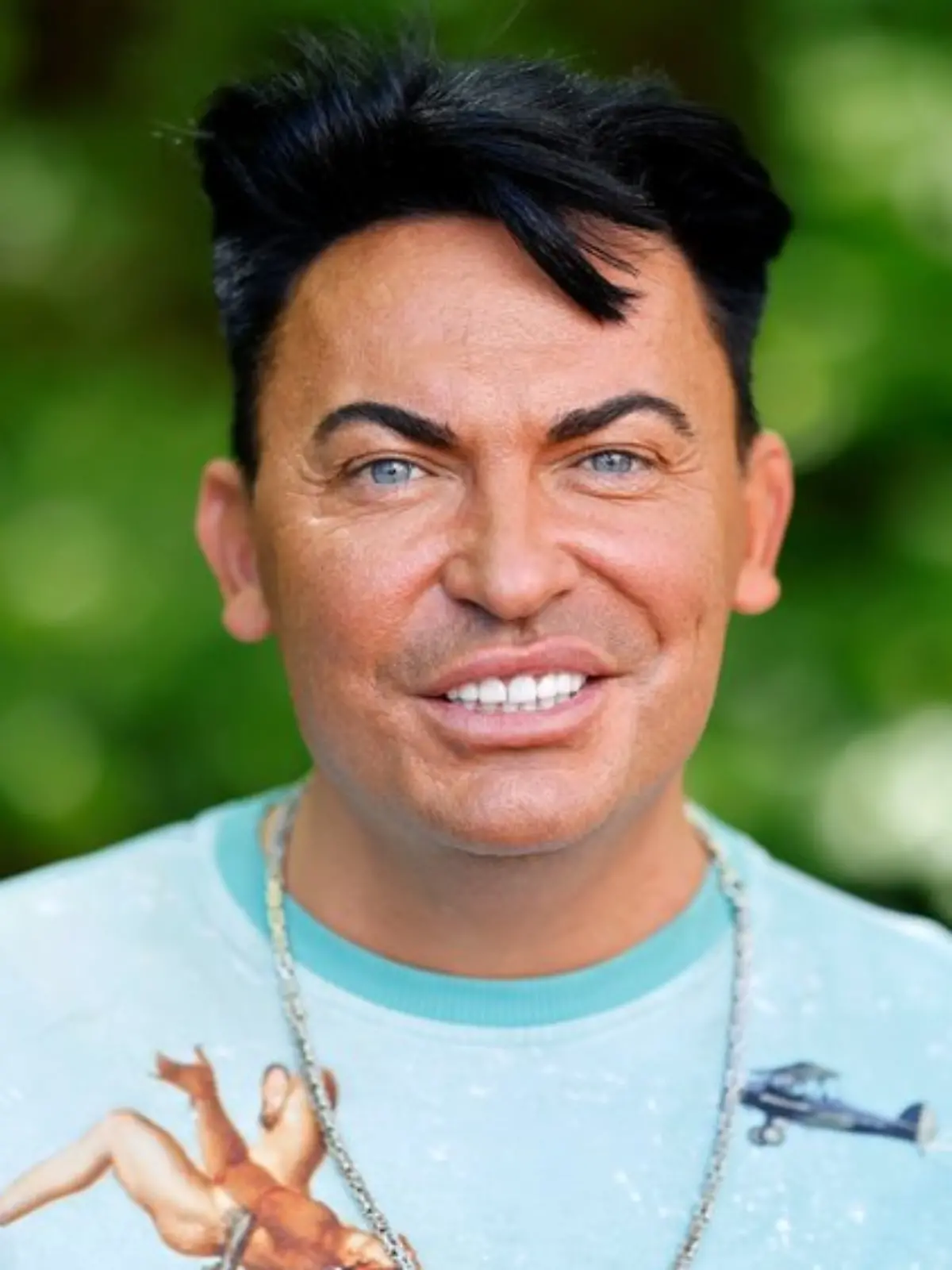 Matthias Mangiapane hat in den vergangenen Monaten viel Gewicht verloren.