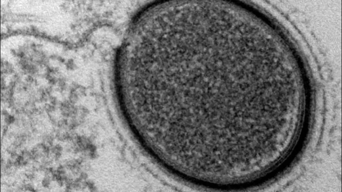 Virus Permafrost J.M. Claverie PNAS CNRS