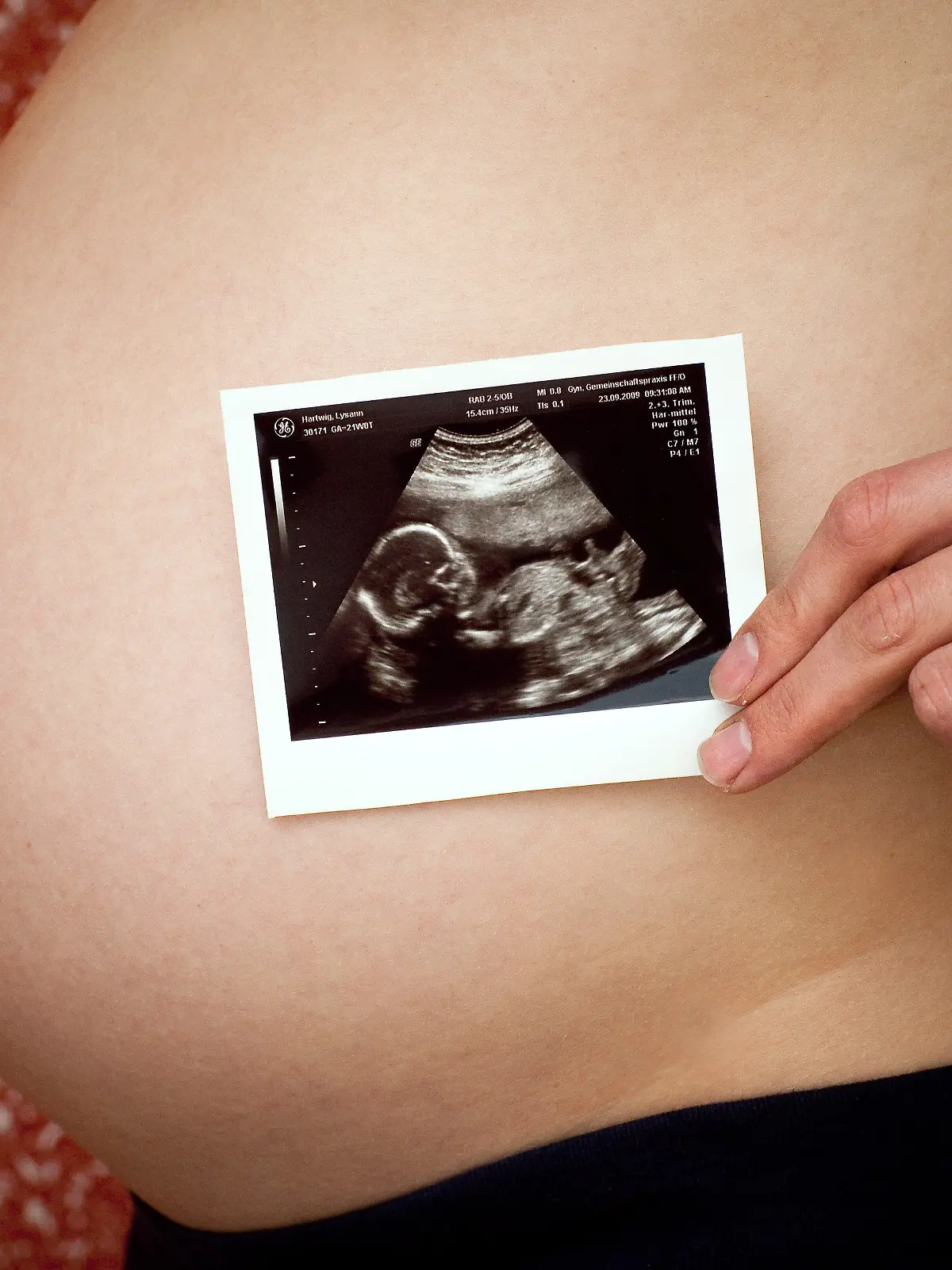 ARCHIV - Eine im 8. Monat schwangere Frau zeigt ein Ultraschallbild vor ihrem Babybauch, aufgenommen in Frankfurt (Oder) am 02.12.2009). Kaum auf der Welt, und schon im Web: Immer mehr Babies starten ihr Leben mit einem eigenen Internetprofil. Ultraschallfotos, Eltern-Tweets während der Schwangerschaft, Vorstellung der Neugeborenen in Online-Fotoalben, und oft sogar eine eigene E-Mail-Adresse begleiten die «Digital Natives» auf dem Weg ins Leben. Sonogramme aus der Zeit vor der Geburt gibt es im Web von 15 Prozent der Babies in Deutschland (international 23 Prozent). Foto: Patrick Pleul dpa (zu dpa 0090 vom 22.10.2010)  +++(c) dpa - Bildfunk+++