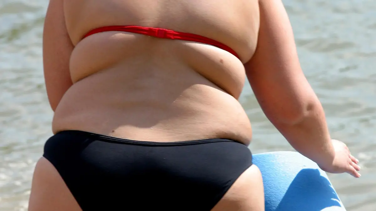 Obese woman on a beach in Sala in Slovakia, 28.06.2005. Foto: Miroslav Foldesi +++(c) dpa - Report+++