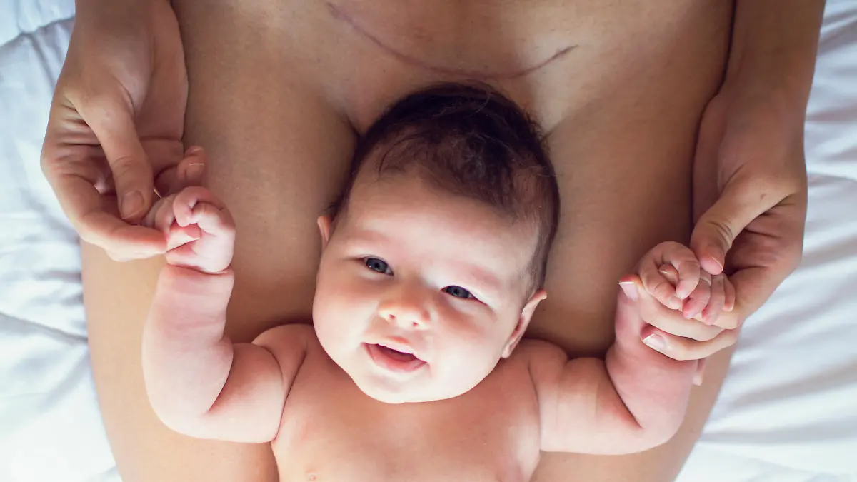 Kaiserschnitt-Baby