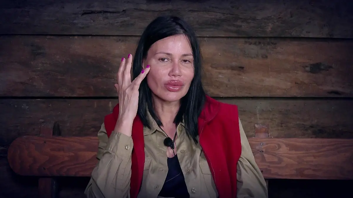 Djamila Rowe steht zu ihren Beauty-Maßnahmen.