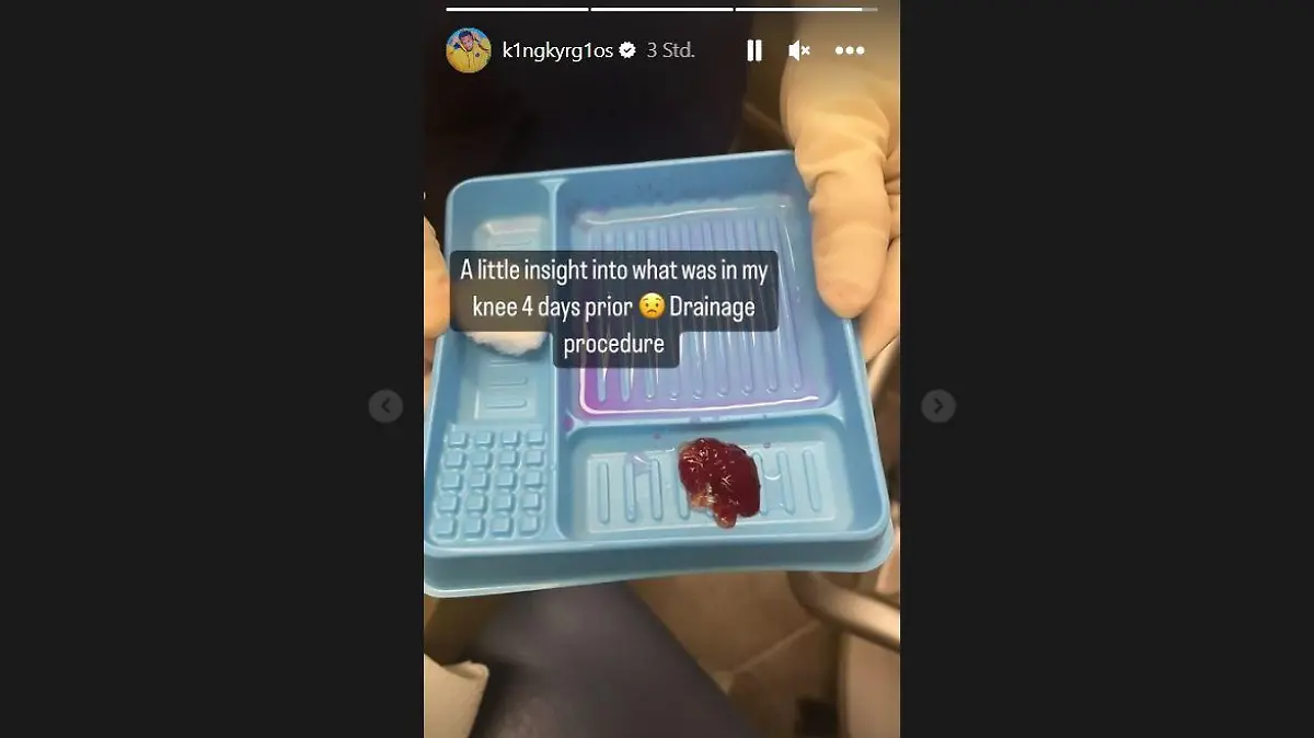 Kyrgios teilt ein Bild bei Instagram.