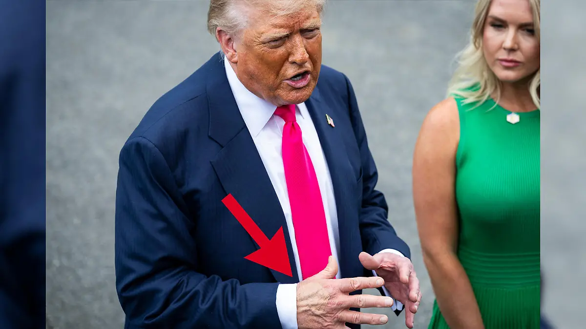 Auffälliger Fleck auf Trumps Hand – Weißes Haus nennt skurrile Begründung Rätsel um diesen Auftritt!