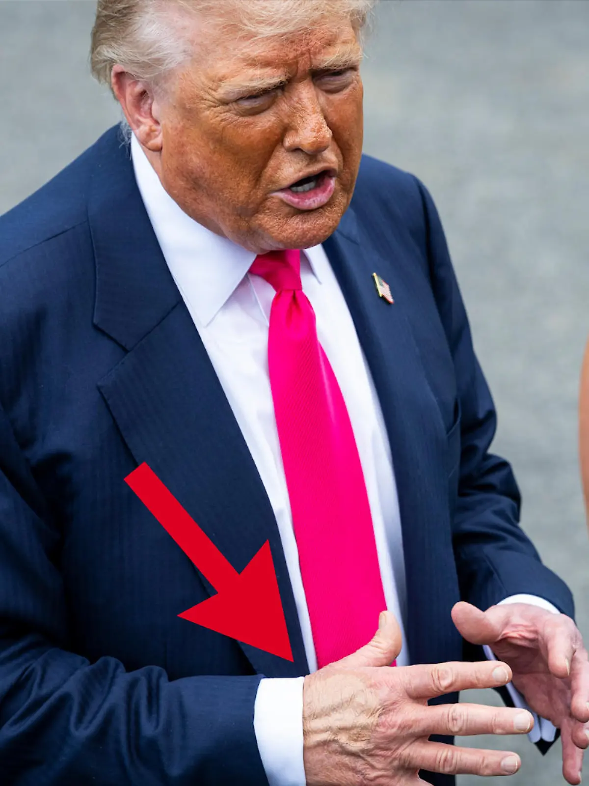 Bild zu: "Auffälliger Fleck auf Trumps Hand – Weißes Haus nennt skurrile Begründung"
