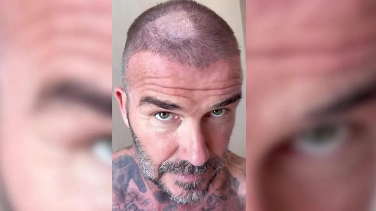 Plötzlich kahl! Fieser Haar-Fail bei Ex-Fußballstar David Beckham Victoria findet es „schrecklich"
