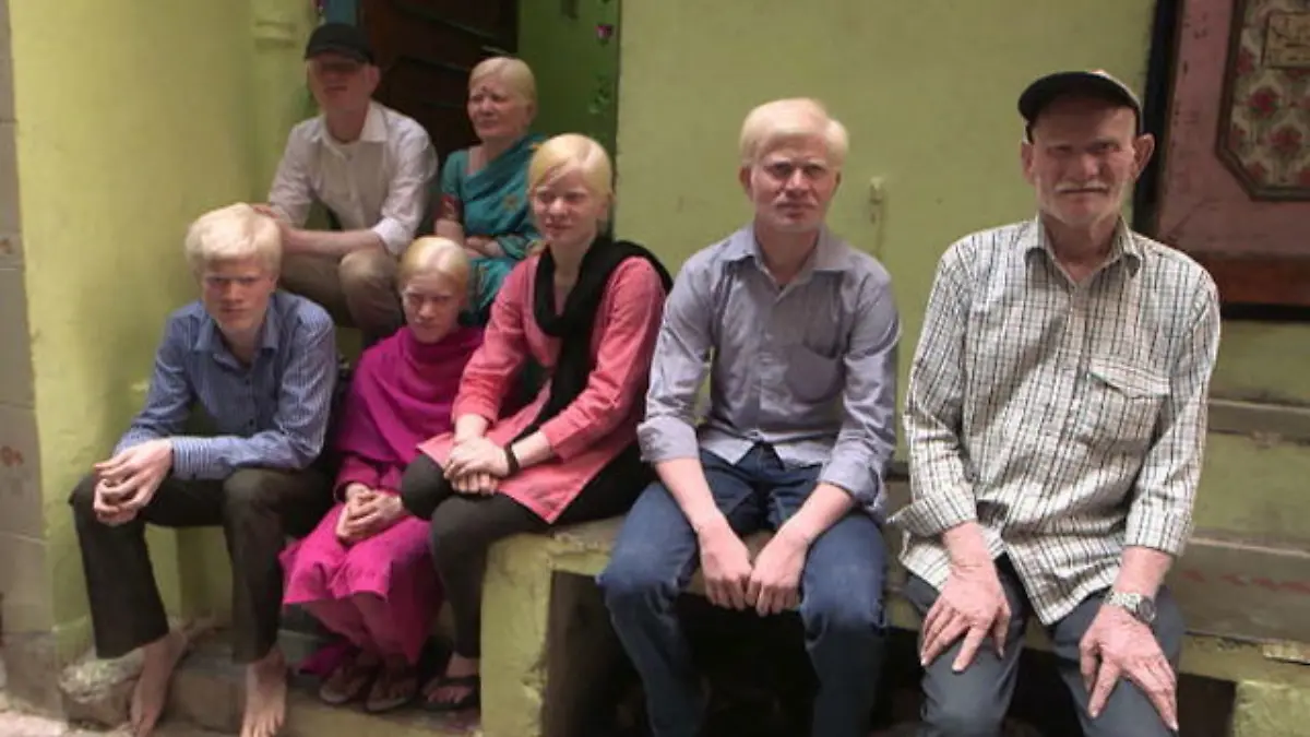 Albino-Familie Indien