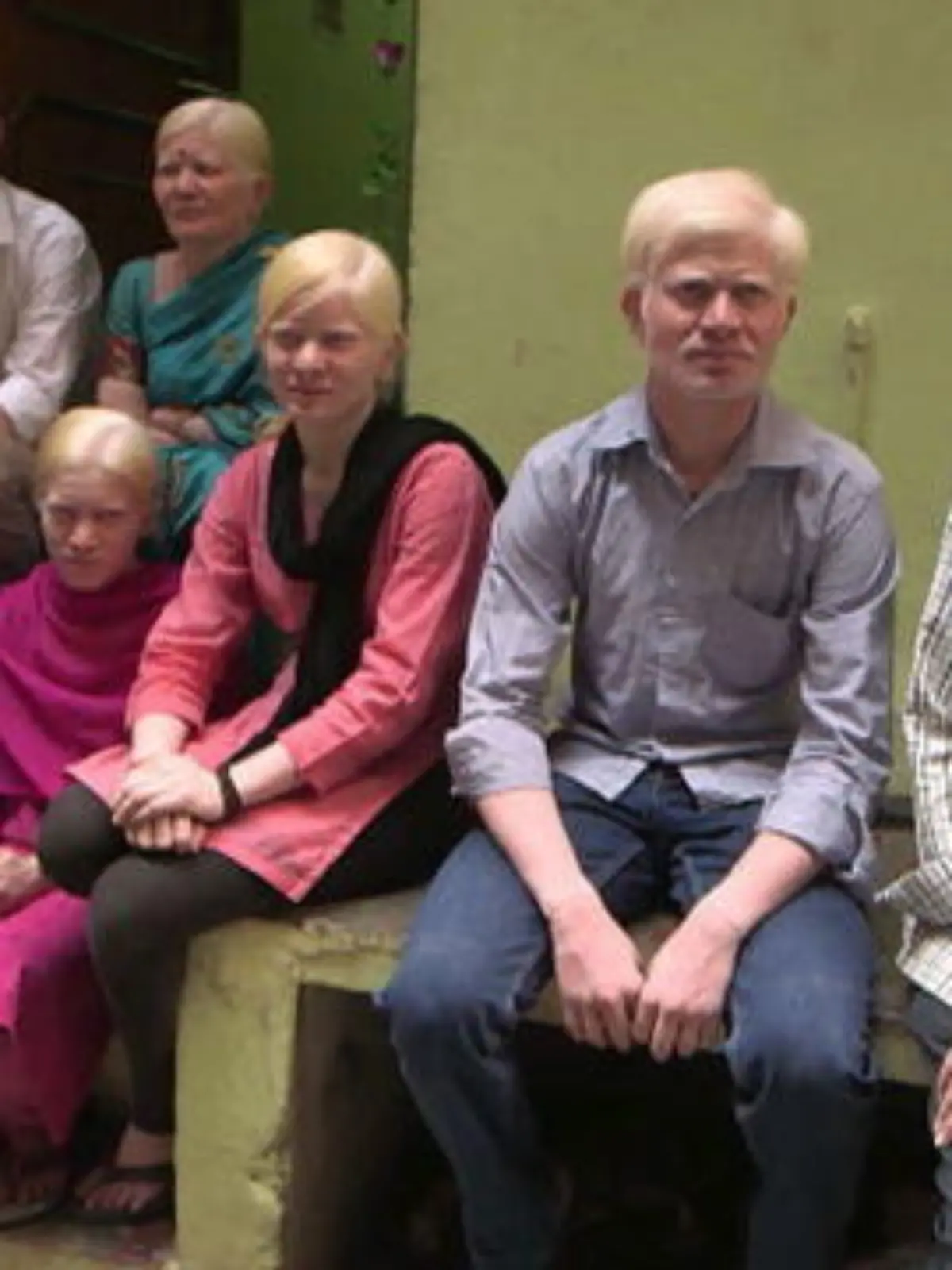 Albino-Familie Indien