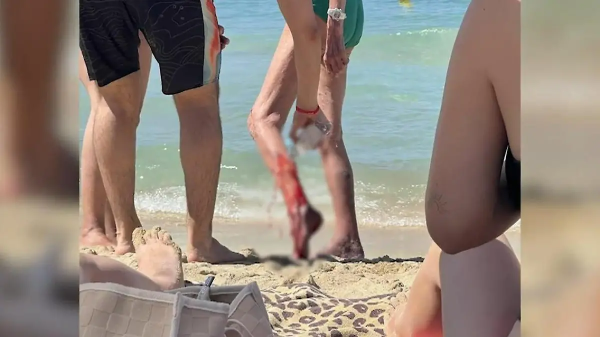 Hai-Alarm am Ballermann! Mallorca-Touristin ins Bein gebissen Retter berichtet über Angriff