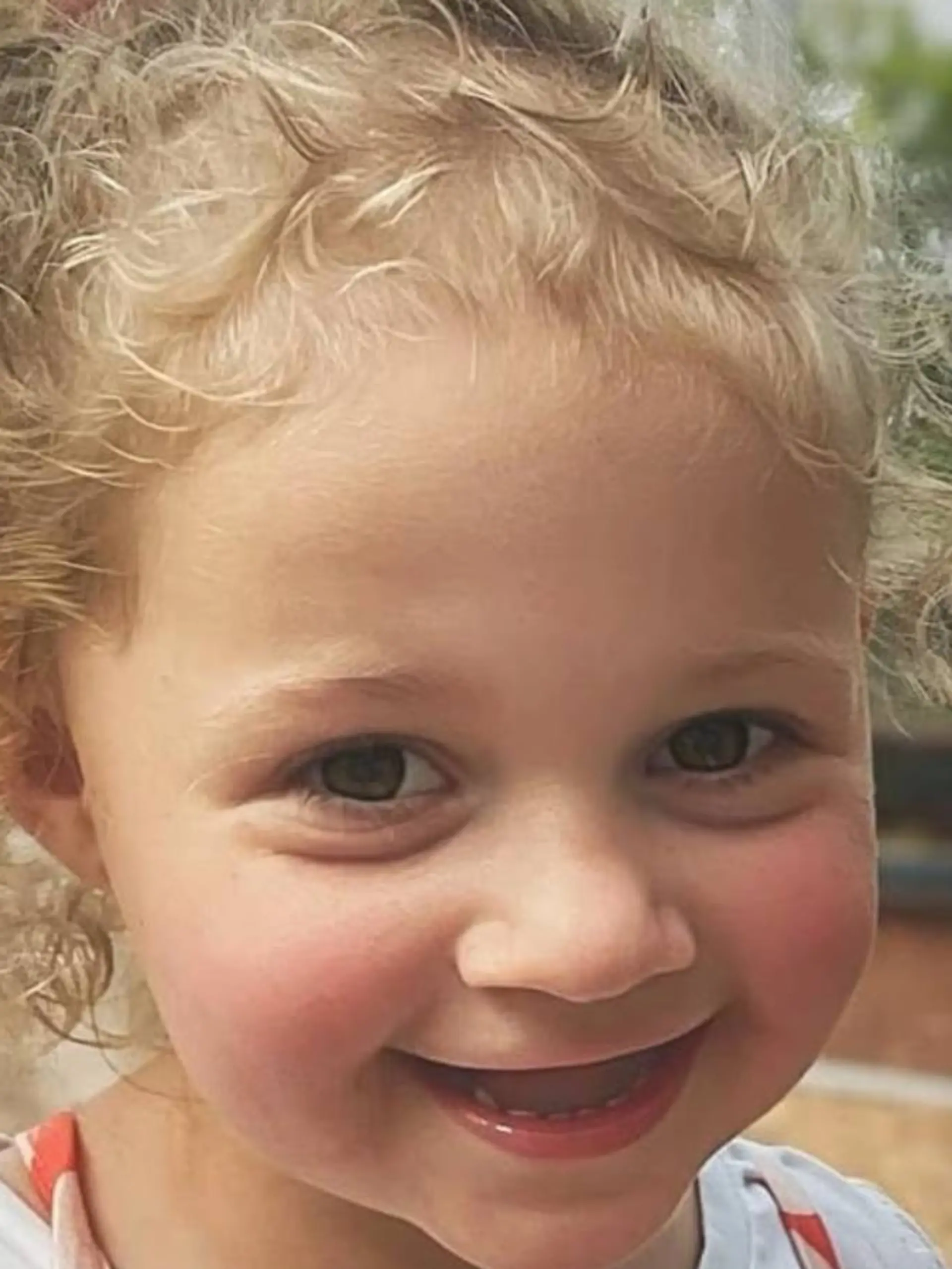 Millie Anthony aus Australien hat beim Spielen zwei Magnete verschluckt. Jetzt bangen die Eltern der Dreijährigen um ihr Leben. 