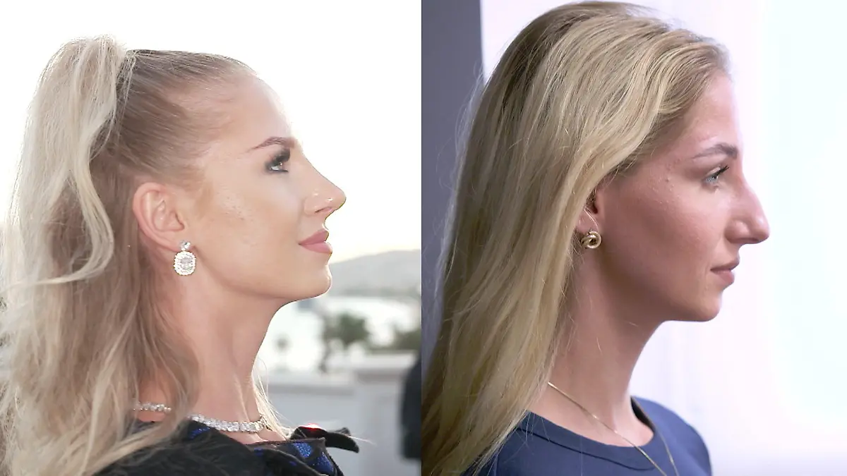 Für Sarahs Traum vom Modeln zahlt Papa die Beauty-OP Verliert sie ihr Markenzeichen?