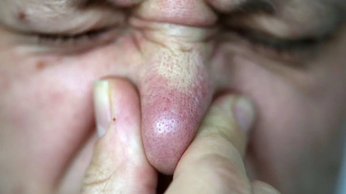 Ein Flug in der Economy-Klasse kann neben einem Viel-Pupser zur Herausforderung werden (Archivbild)