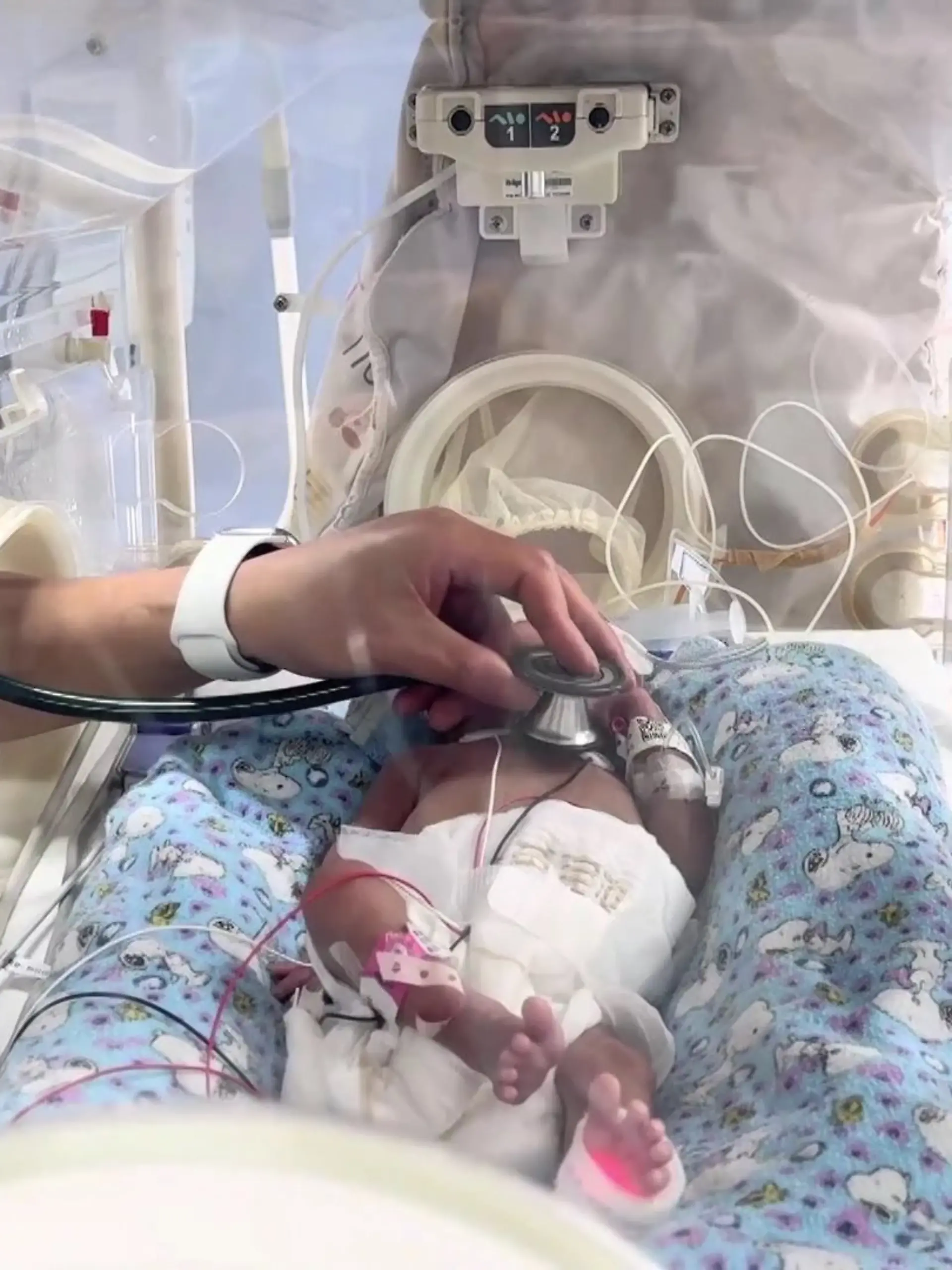 Baby Dongdong wird im Brutkasten untersucht