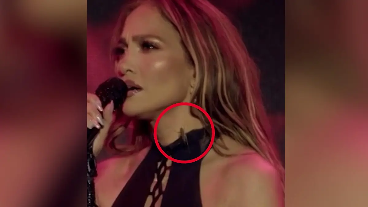 So nah kommt ihr keiner! Heuschrecke bekrabbelt Jennifer Lopez bei Live-Konzert Wie reagiert da wohl der Superstar?