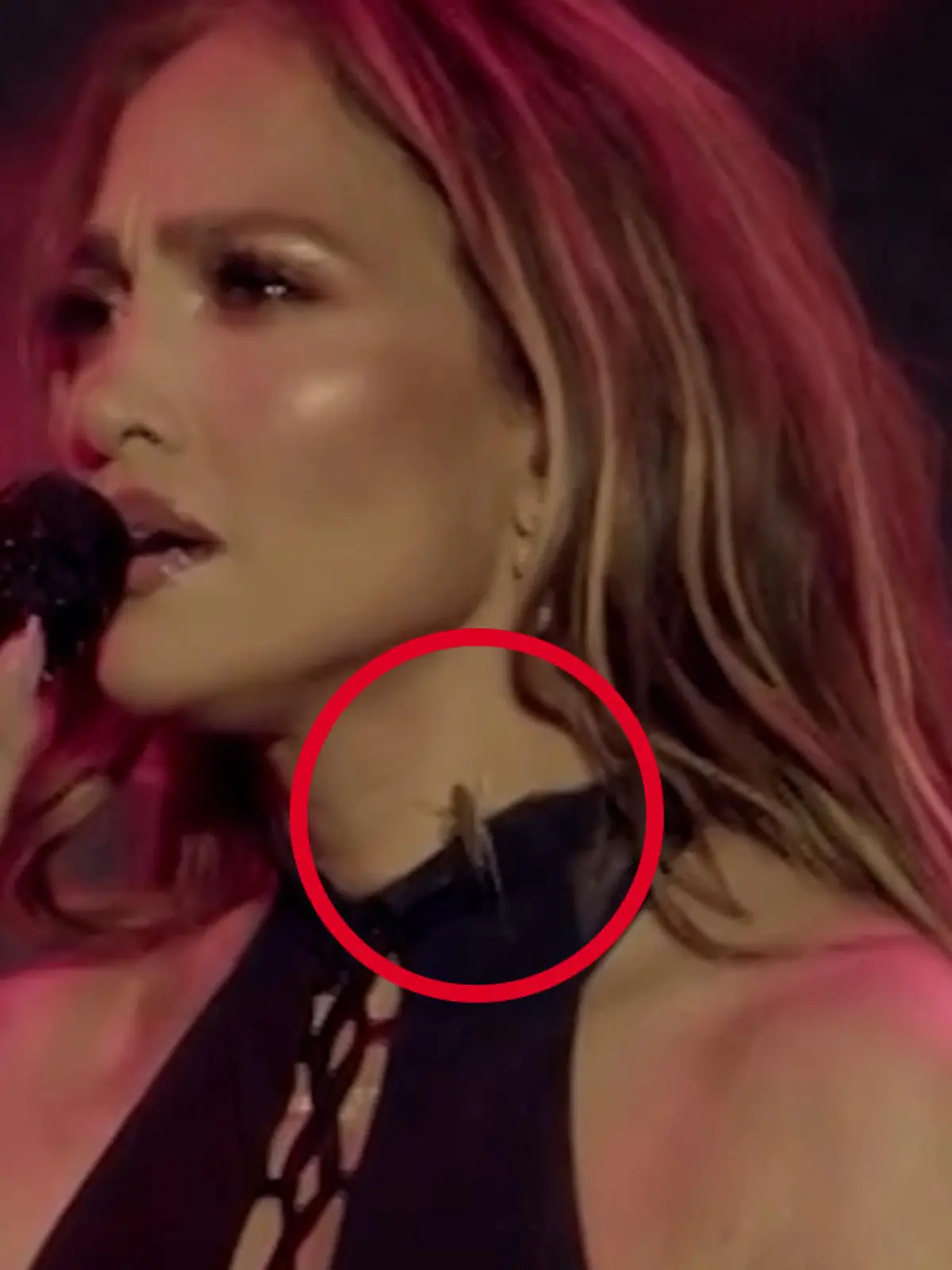 So nah kommt ihr keiner! Heuschrecke bekrabbelt Jennifer Lopez bei Live-Konzert