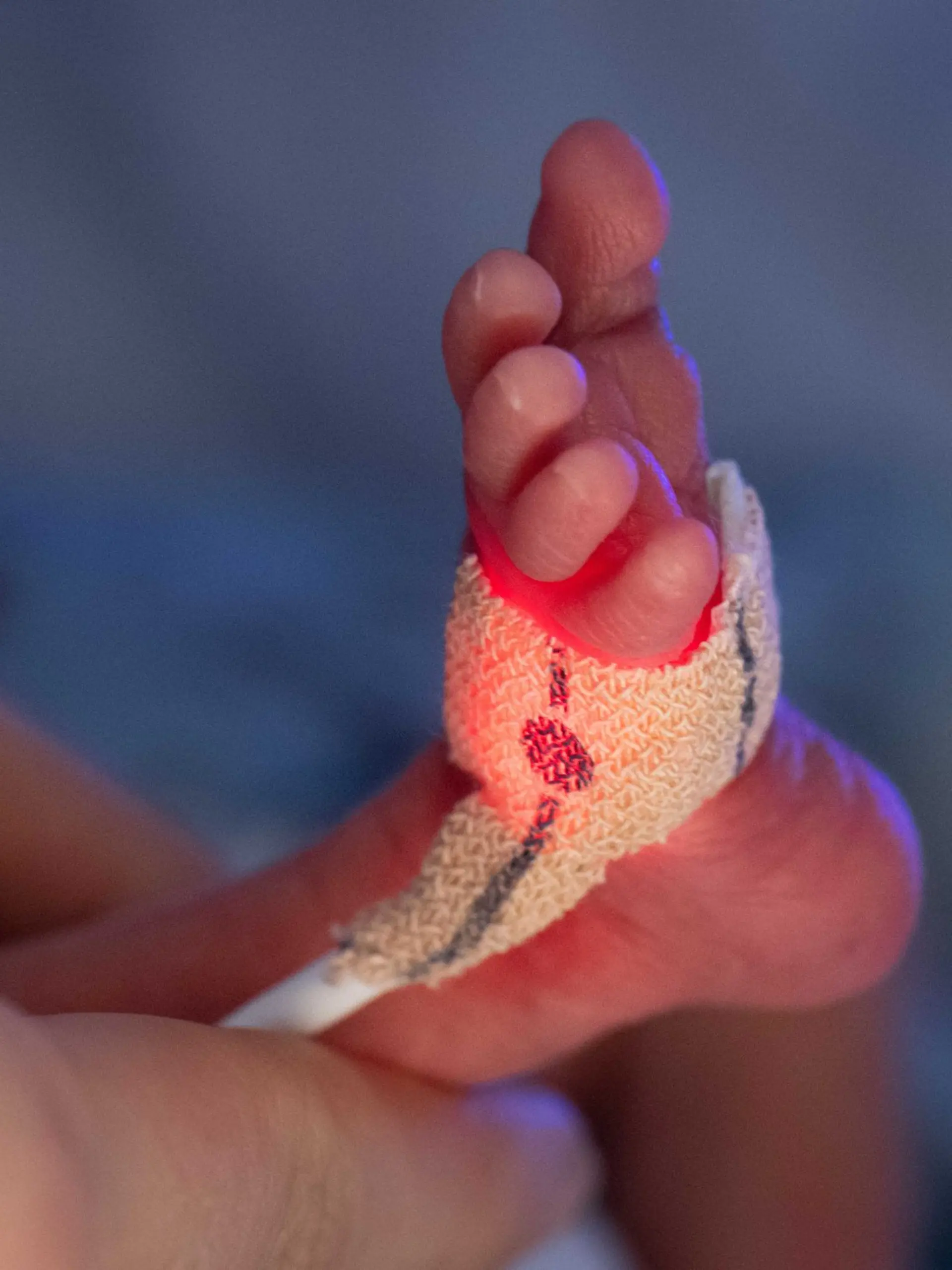Bild zu: "Baby in Indien lebendig begraben – jetzt kämpft es um sein Leben"