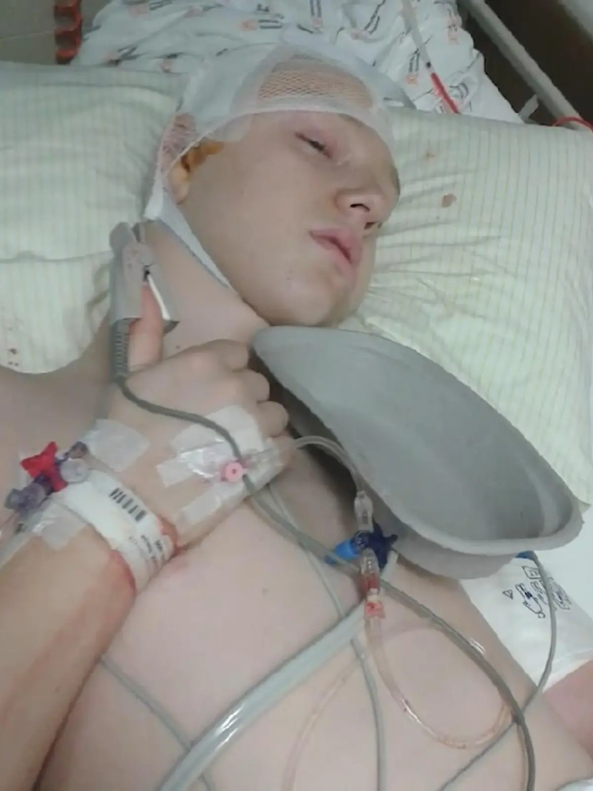 Bild zu: "Schlaganfall mit 13 Jahren"