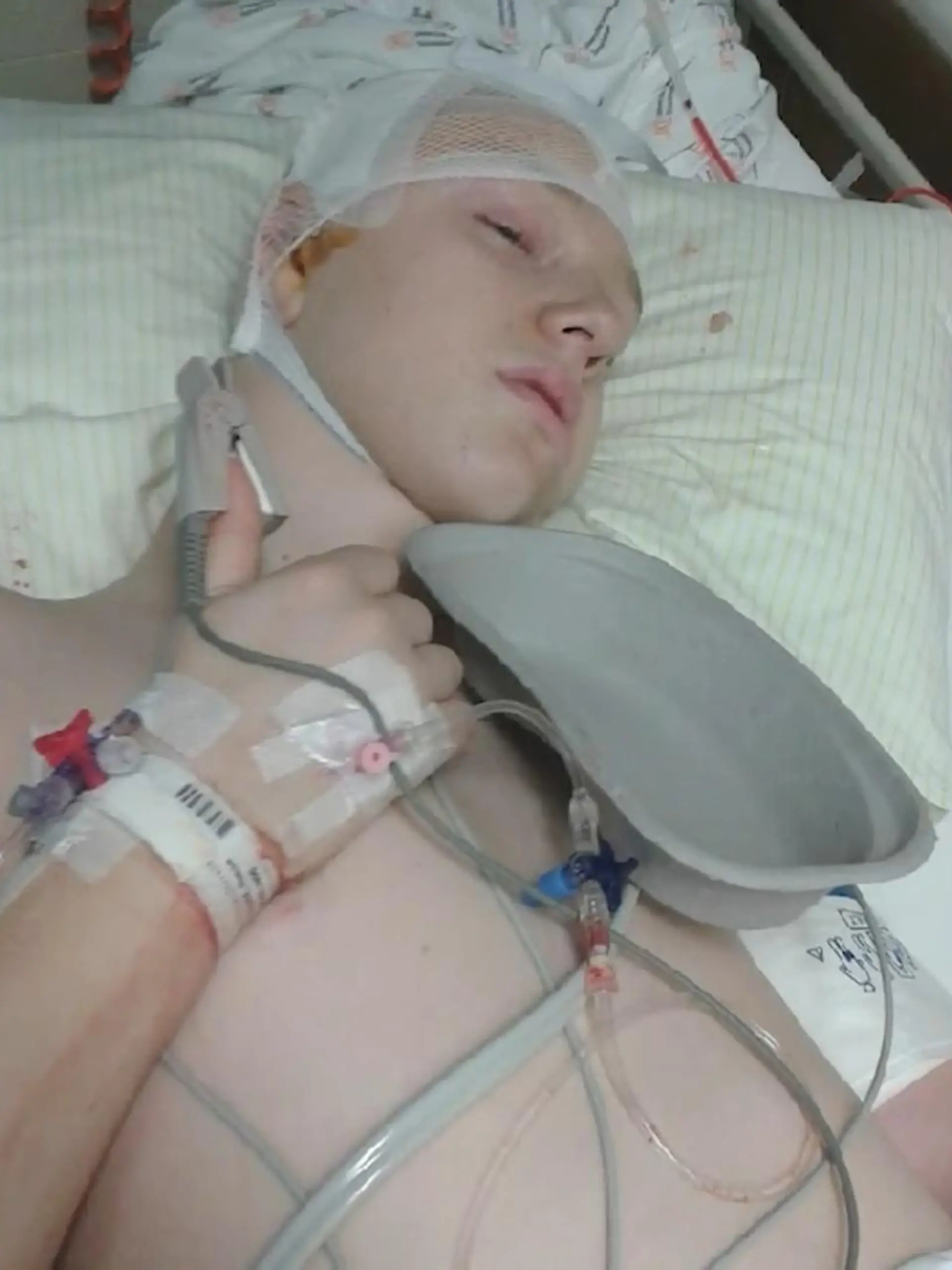 Bild zu: "Schlaganfall mit 13 Jahren"