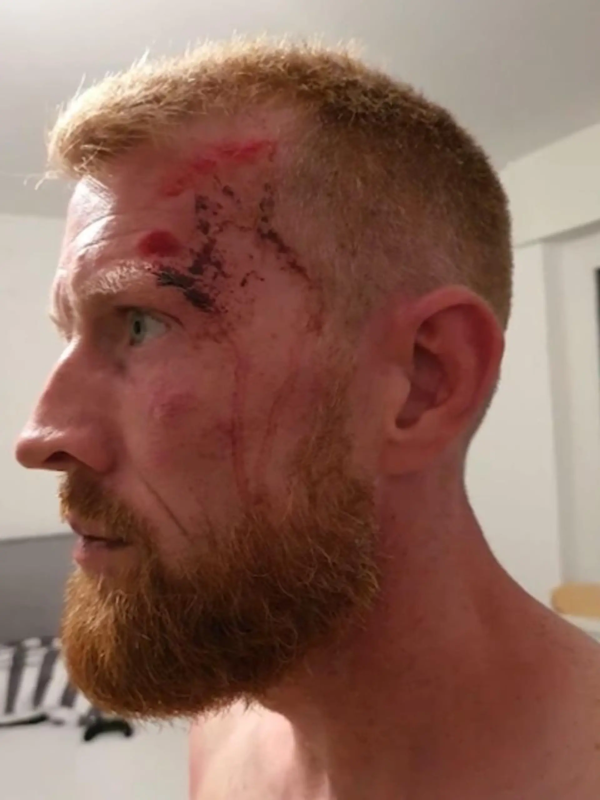 Der Innenausschuss des hessischen Landtages befasste sich heute mit einem Polizeieinsatz, der sich im September 2020 im hessischen Idstein ereignete. Der damals 38-jährige Kampfsportler Liam Conway soll von Polizeikräften vor der Polizeiwache Idstein gewaltsam attackiert worden sein. Ein aufgezeichnetes Überwachungsvideo stütze die Aussage des Kampfsportlers und zeigt, wie ein Polizist auf den damals 38-Jährigen einschlägt. Nun zeigt Innenminister Peter Beuth Verständnis für die Einsatzkräfte, mehr dazu im Video.