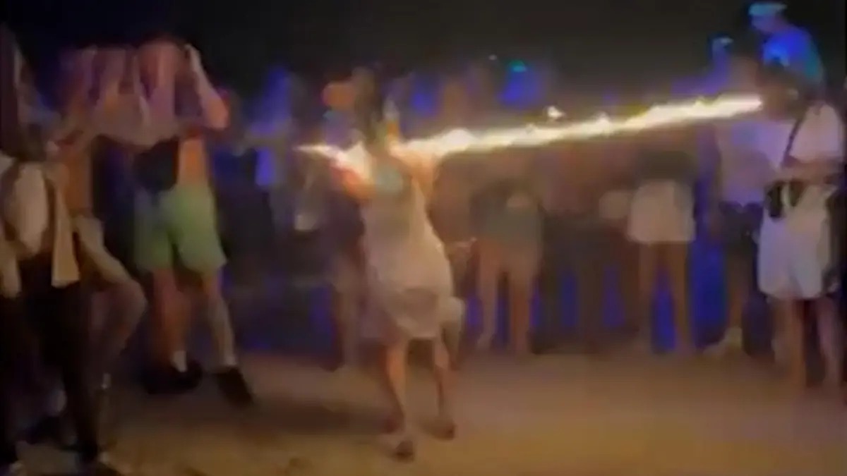 Feuer-Unfall im Urlaub! Karen nach gefährlichem Party-Spiel entstellt „Ich konnte meinen Hals nicht mehr bewegen!"