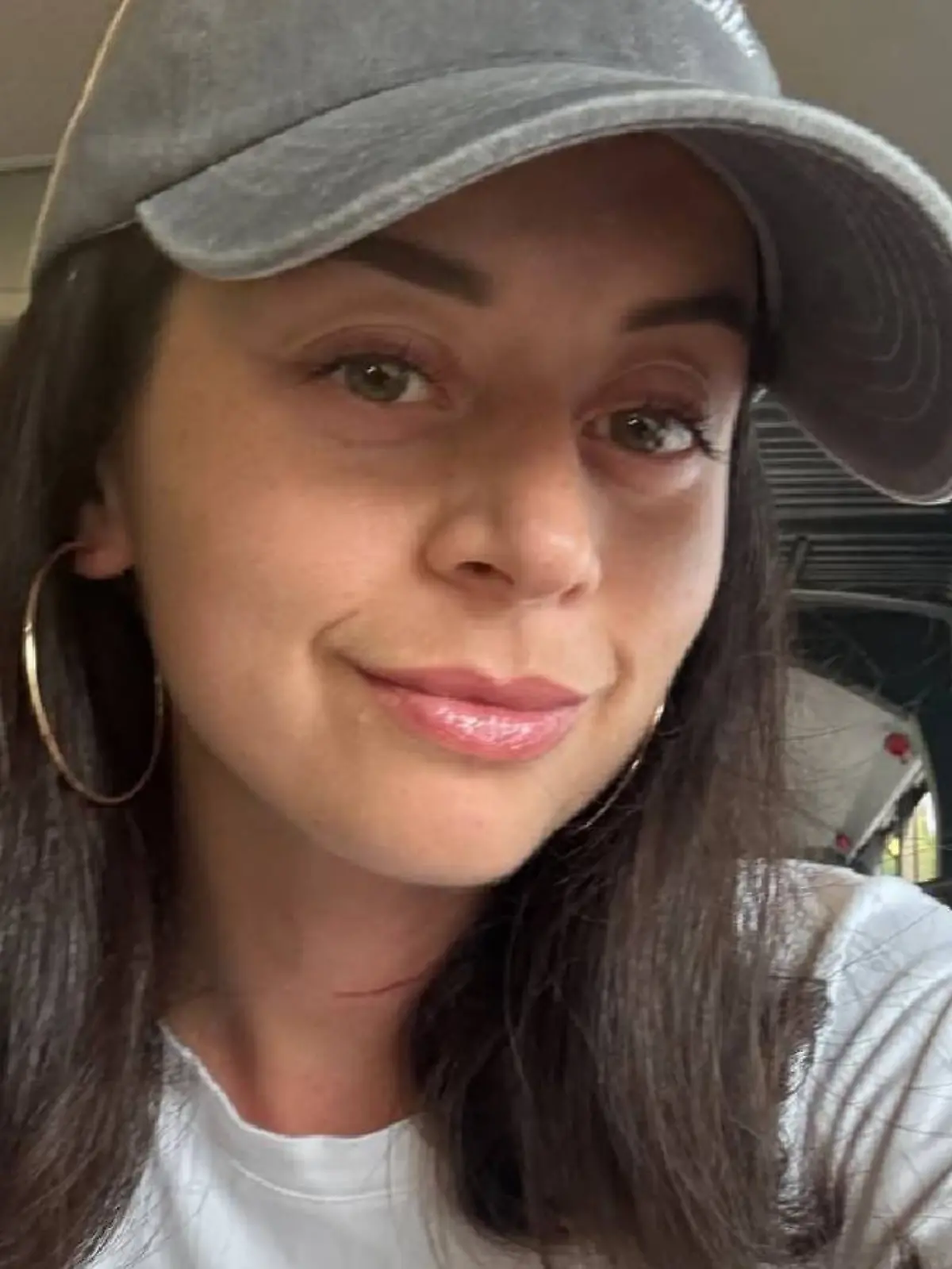 Malika Dzumaev zeigt ihre OP-Narbe.