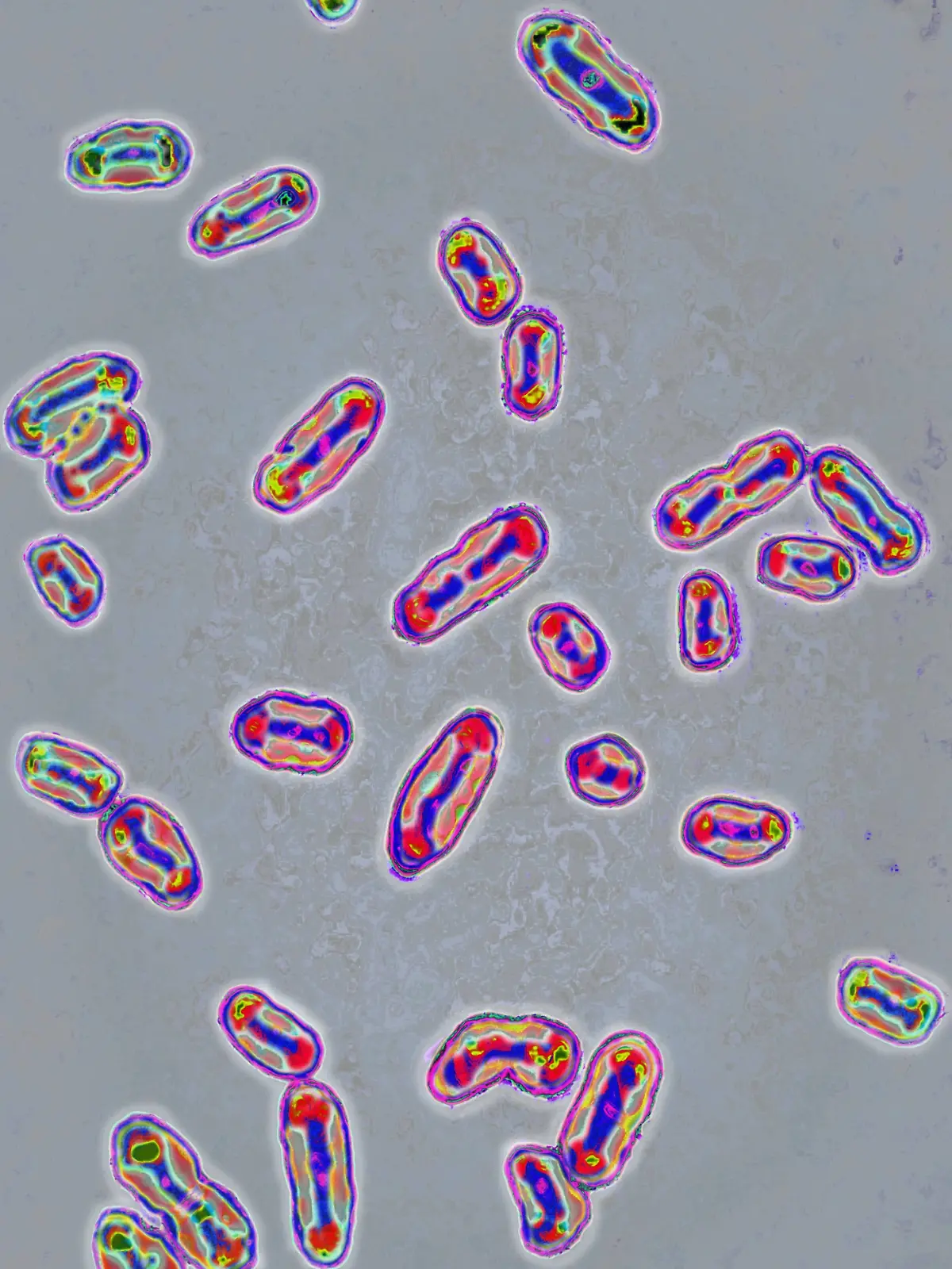 Das Pest-Bakterium Yersinia pestis