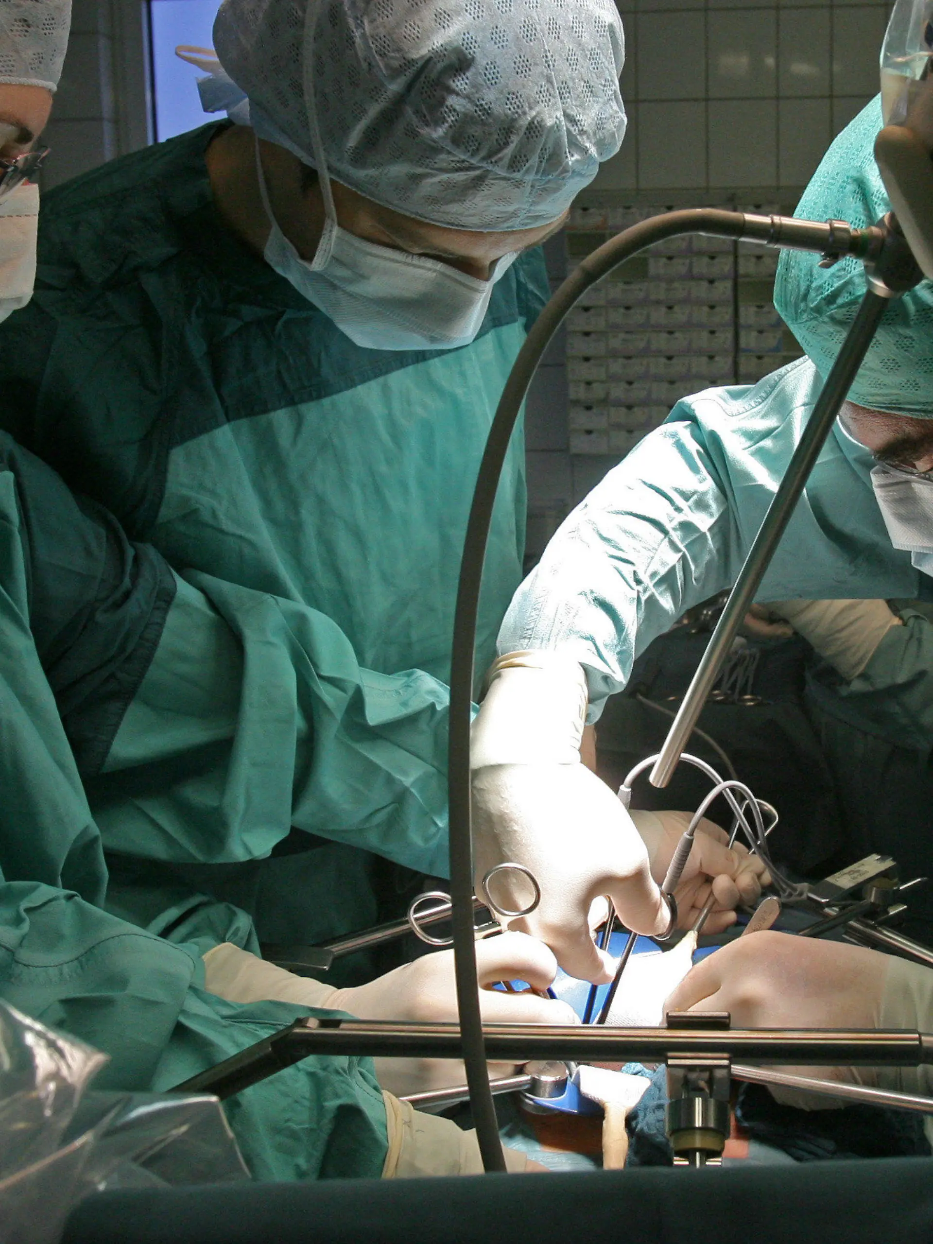 ARCHIV - In einer Deutschen Klinik wird am 15.11.2007 bei einer Operation einem Spender eine Niere entnommen, die für eine Transplantation vorgesehen ist (Illustration zum Thema Transplantation). Nach Unregelmäßigkeiten bei Organspenden an mehreren deutschen Krankenhäusern sind auch am Universitätsklinikum Leipzig Manipulationen aufgedeckt worden. Bei Patienten, die auf eine Lebertransplantation warteten, seien falsche Angaben gemacht worden, um sie auf der Warteliste der Vergabestelle Eurotransplant nach oben zu schieben, sagte der medizinische Vorstand des Uni-Klinikums Leipzig, Fleig, der Nachrichtenagentur dpa. Foto: Jan-Peter Kasper dpa  +++(c) dpa - Bildfunk+++