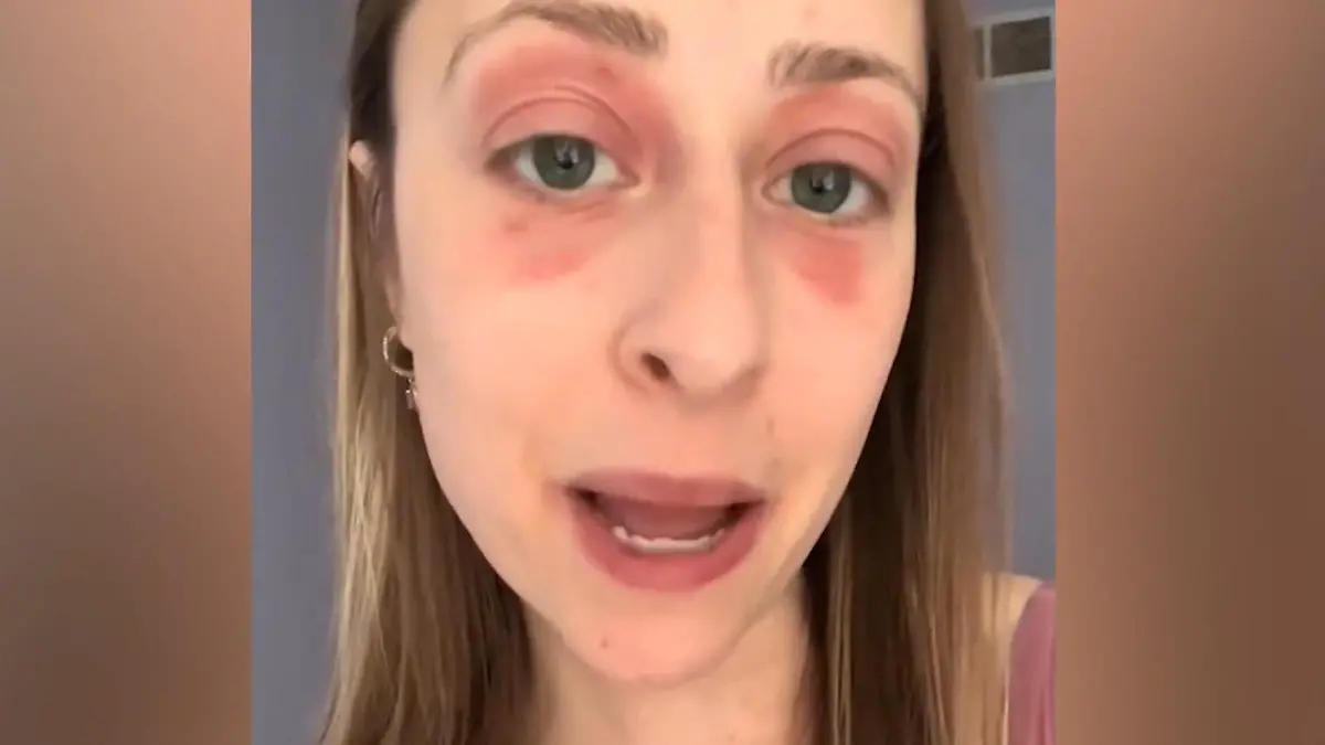 Schimmel-Horror macht Sara krank – und zerstört fast ihre Ehe! Follower retten die 28-Jährige
