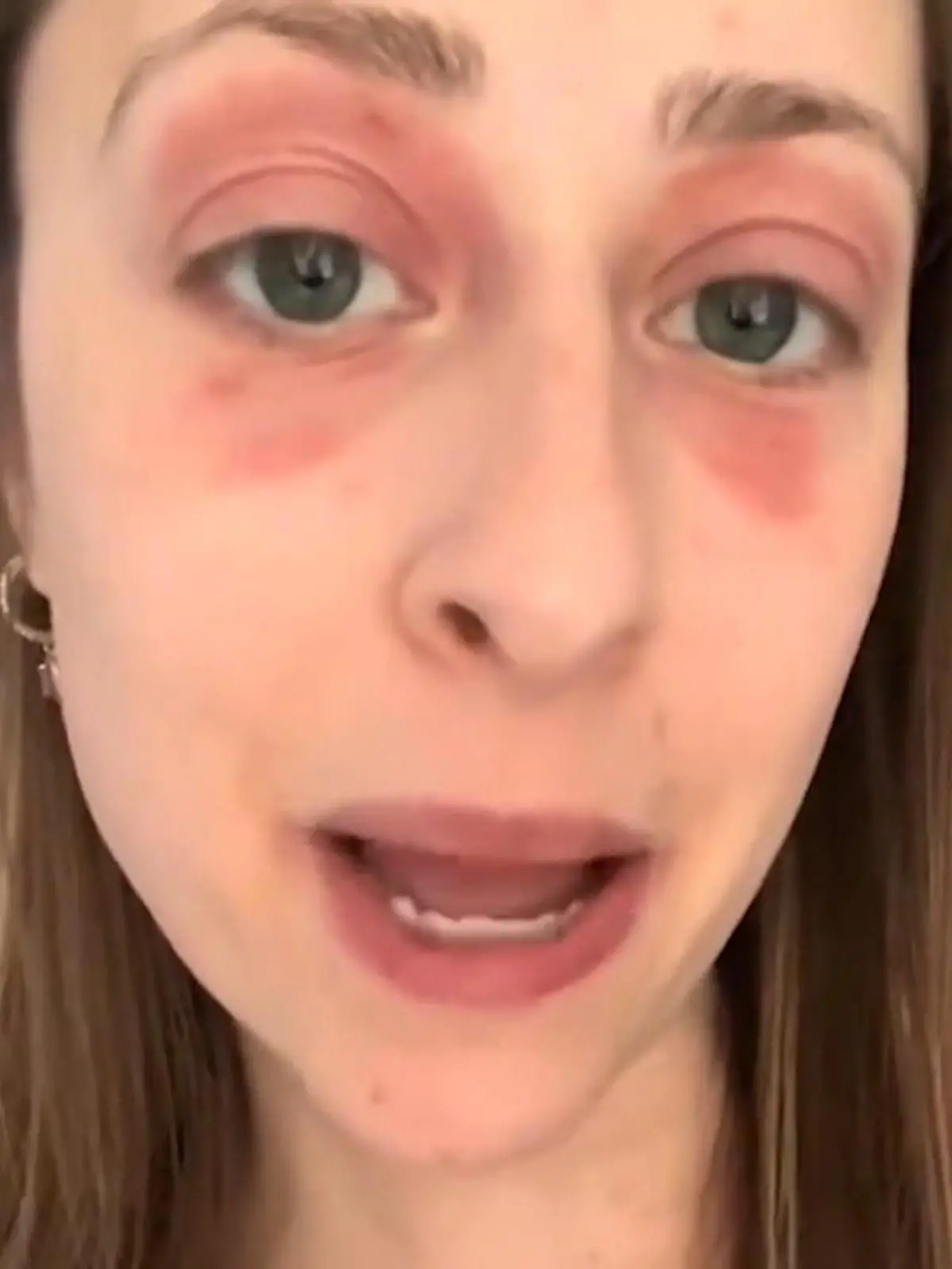 Bild zu: "Schimmel-Horror macht Sara krank – und zerstört fast ihre Ehe!"