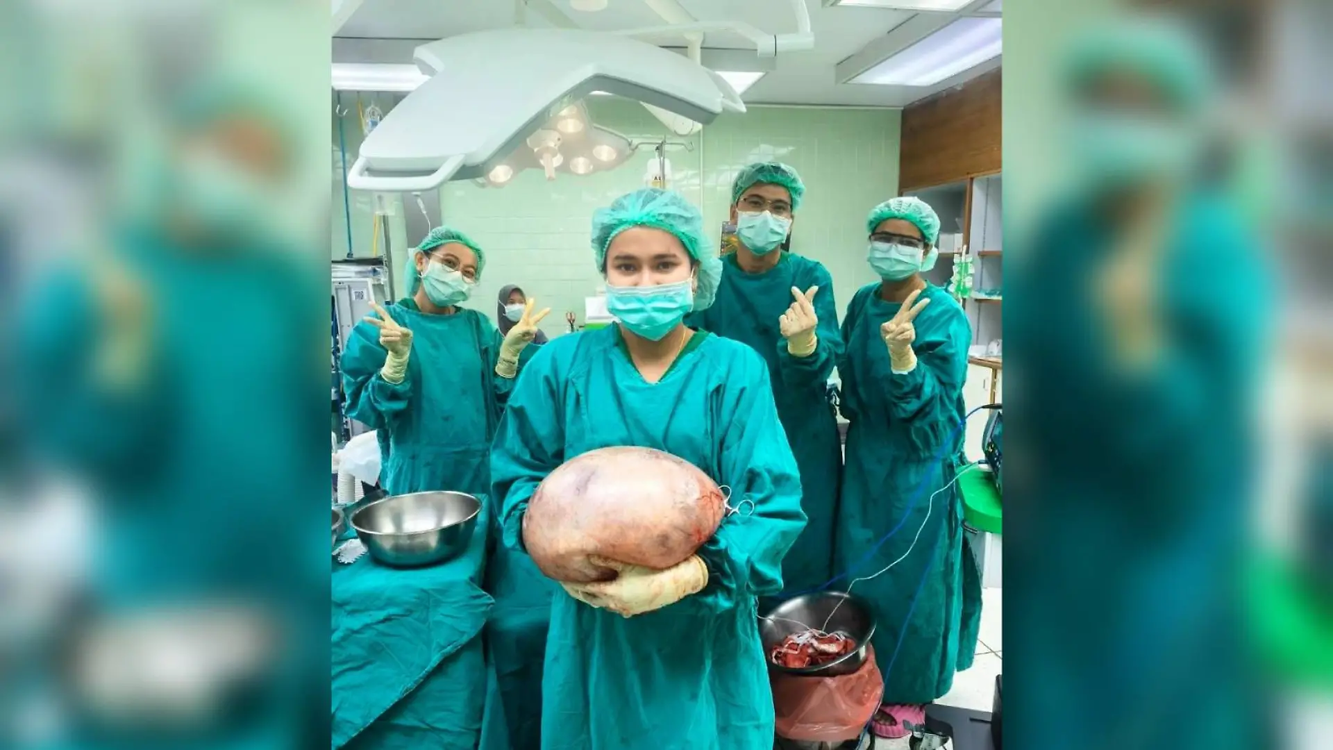  Ärzte aus Satun (Südthailand) holten eine acht Kilogramm schwere Zyste aus den Eierstöcken einer Frau.