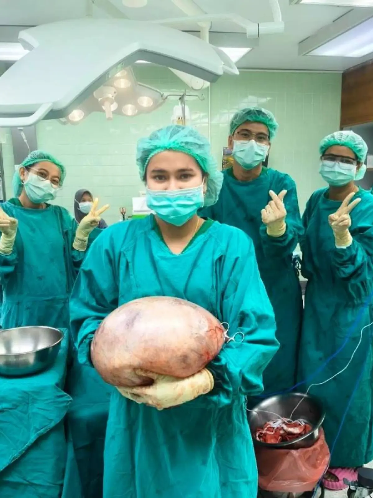  Ärzte aus Satun (Südthailand) holten eine acht Kilogramm schwere Zyste aus den Eierstöcken einer Frau.