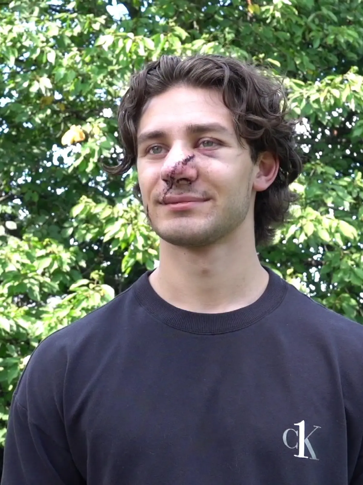 Jonathan ist dankbar für die große Unterstützung und die vielen Nachrichten, die ihn seit dem Angriff erreicht haben. 