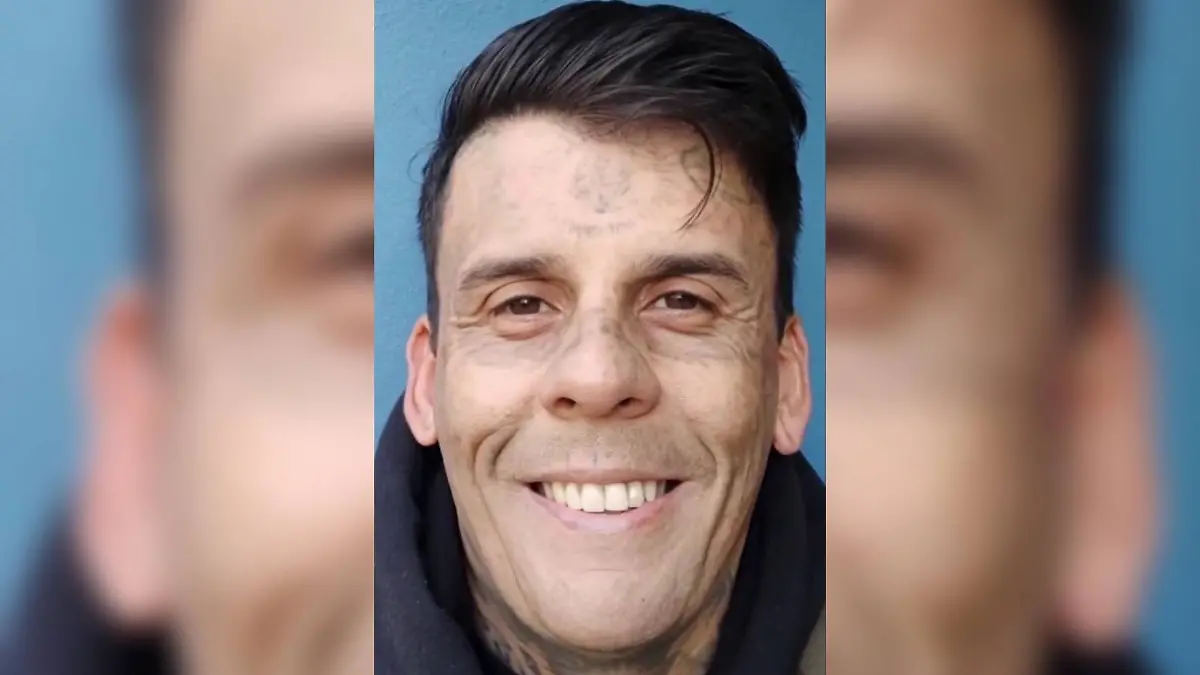 Leandros de Souz hat sich seine Tattoos entfernen lassen.